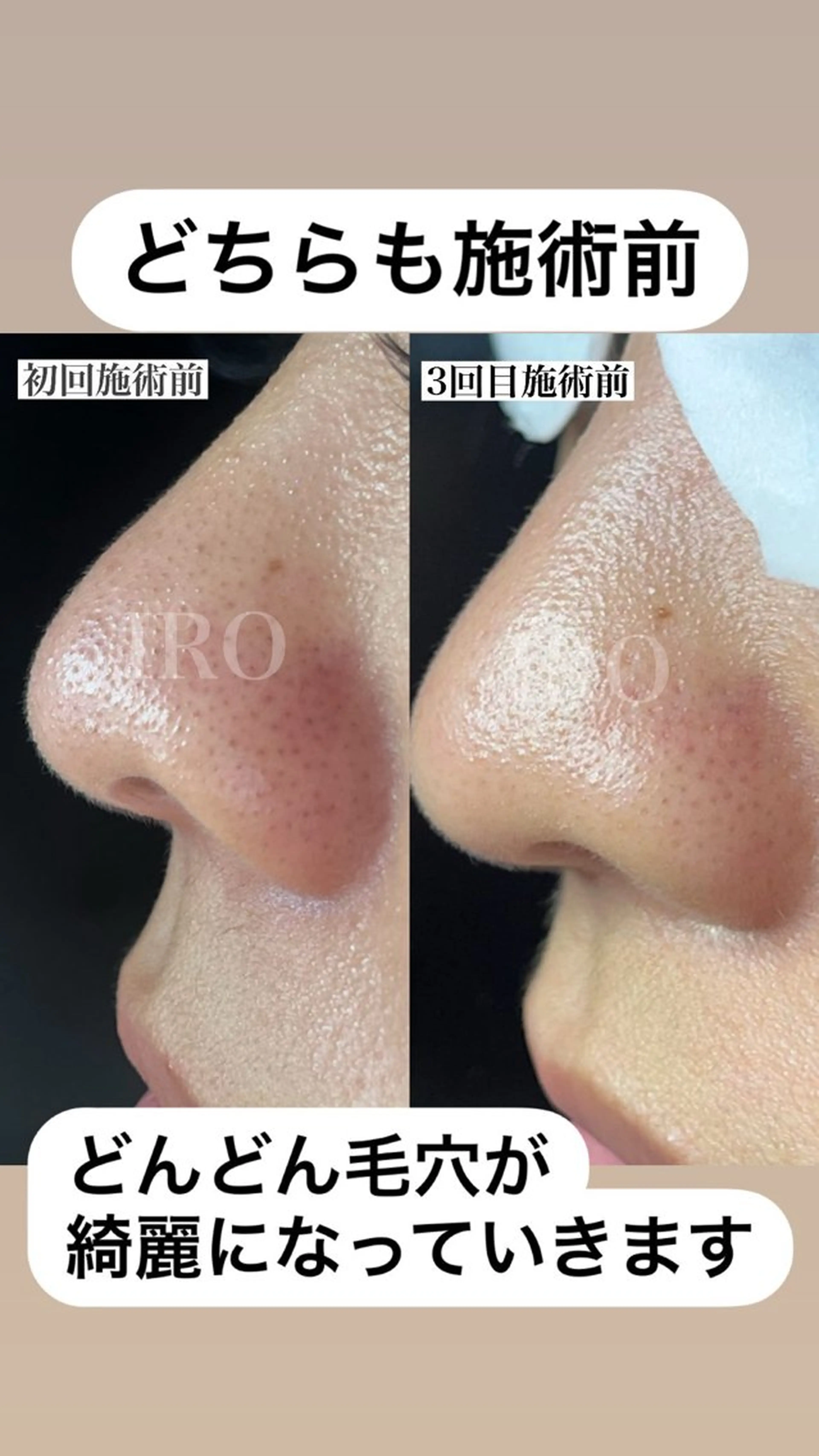 IRO KANAのその他イメージ