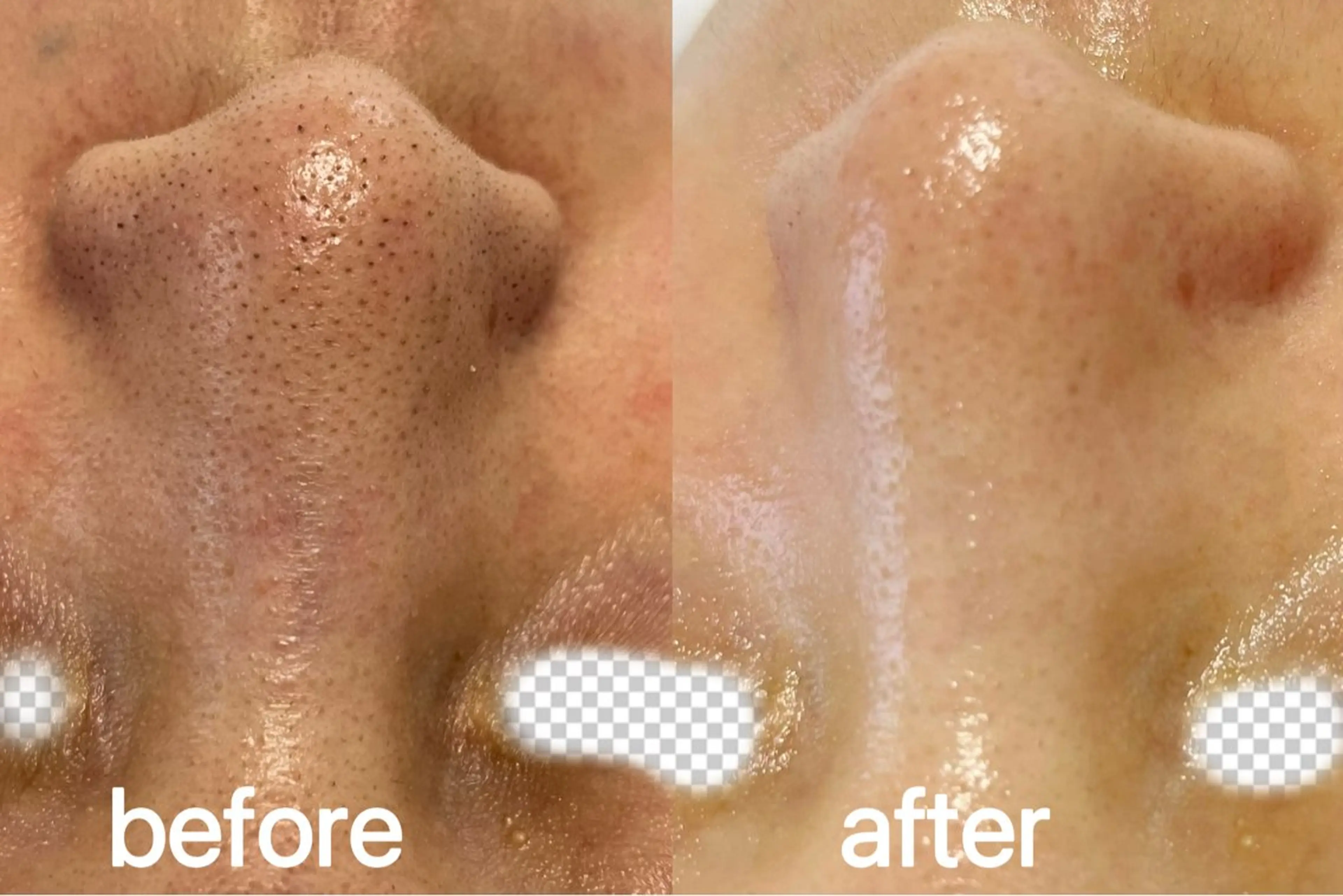 Nature Souce毛穴専門店のその他イメージ