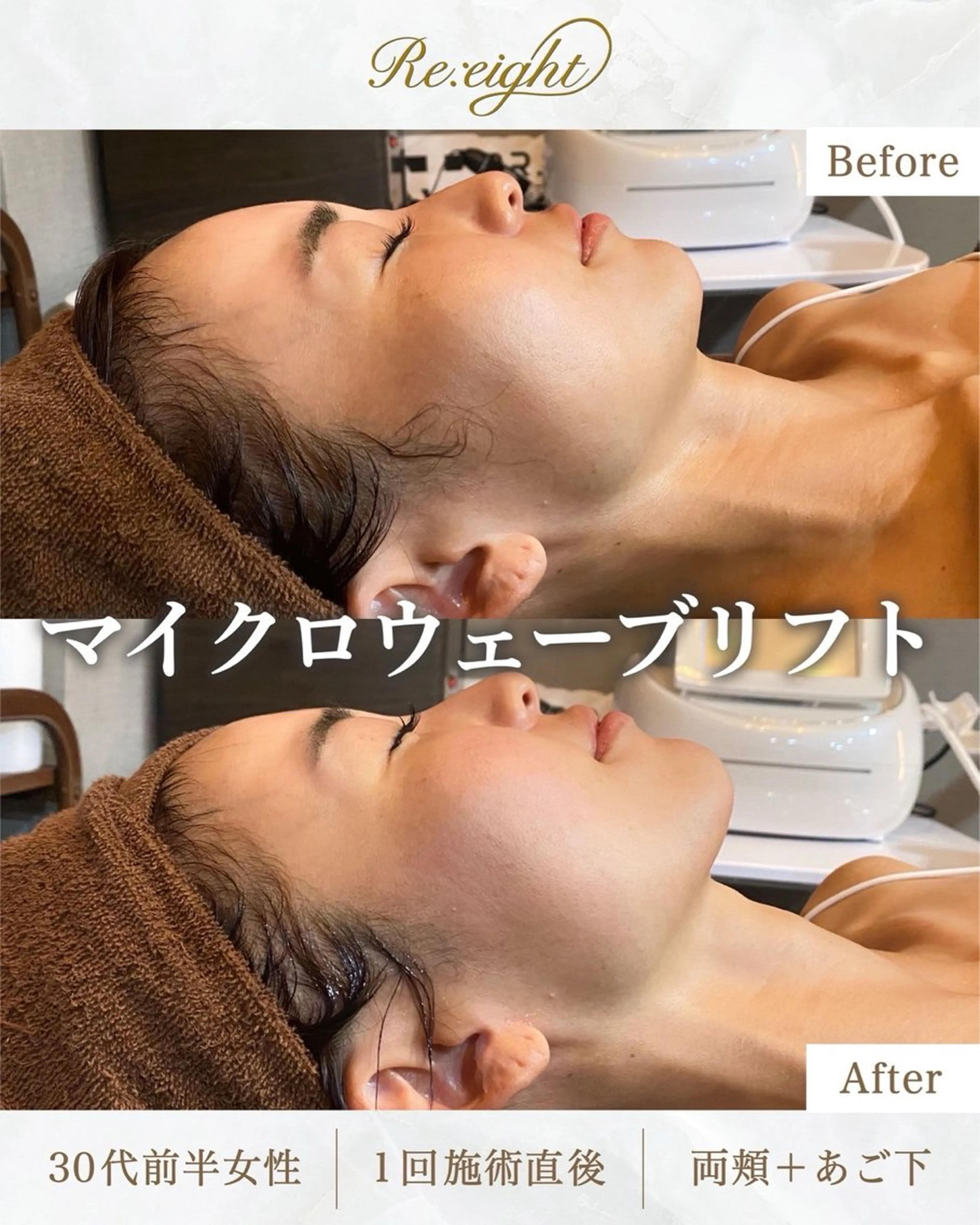 エステ 肌質改善専門 ハーブ /毛穴洗浄 リエイトのエステ・リラクイメージ