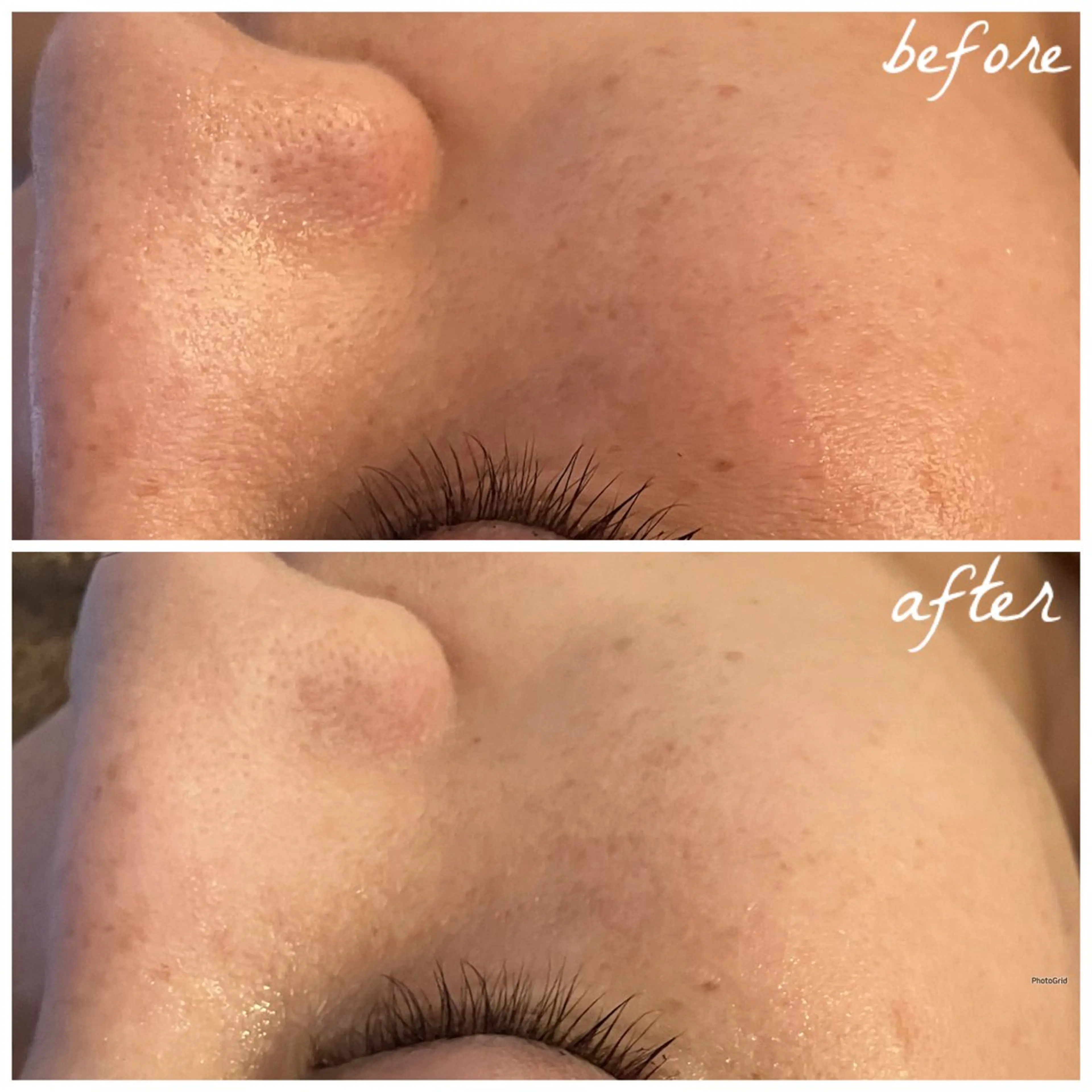 メンズ エステ メナード岐阜茜部 杉浦のエステ・リラクイメージ