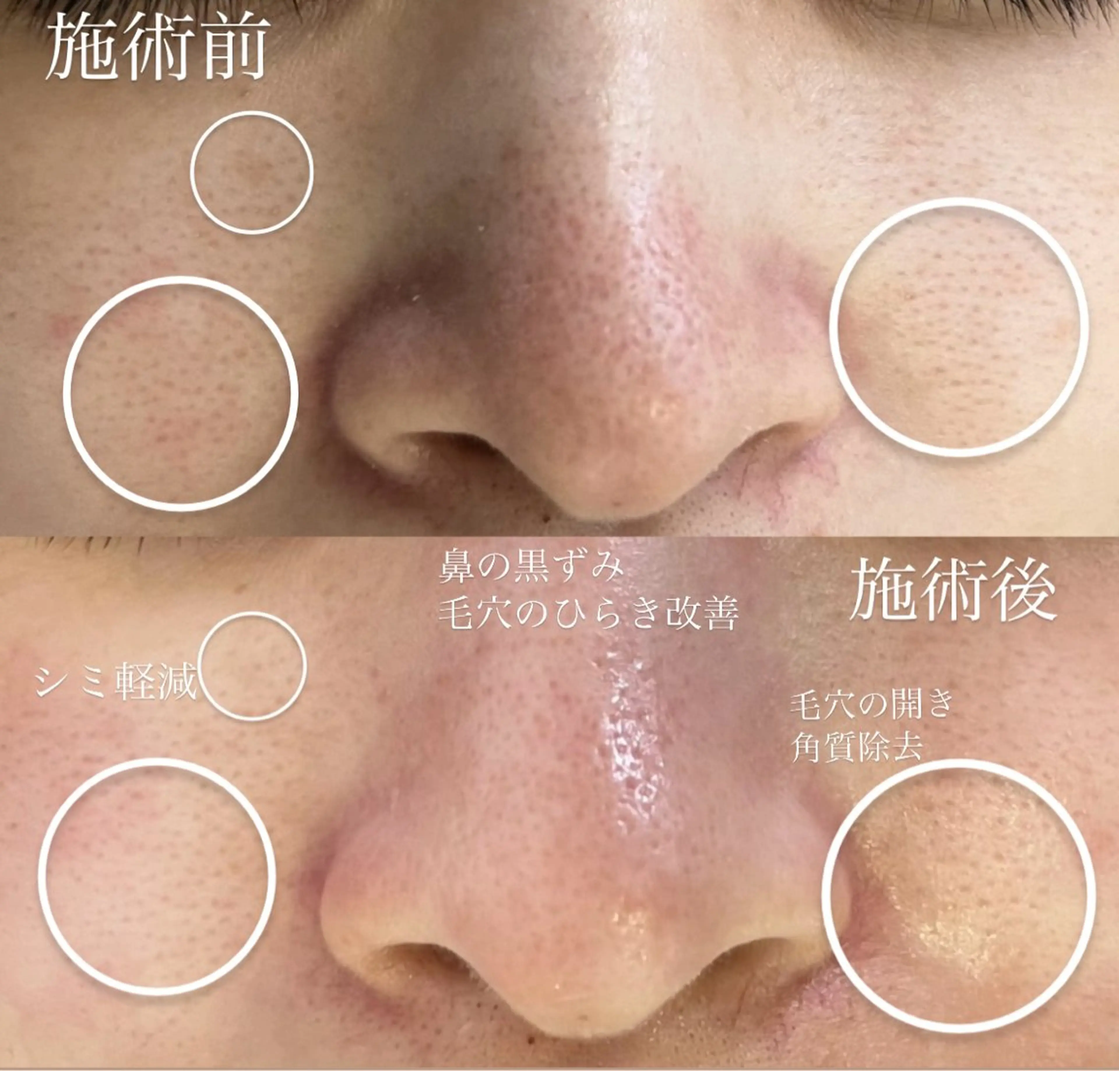 エステ 眉毛専門　美セラピスト　イファ所属・眉毛専門美セラピスト イファの眉毛・アイブロウイメージ