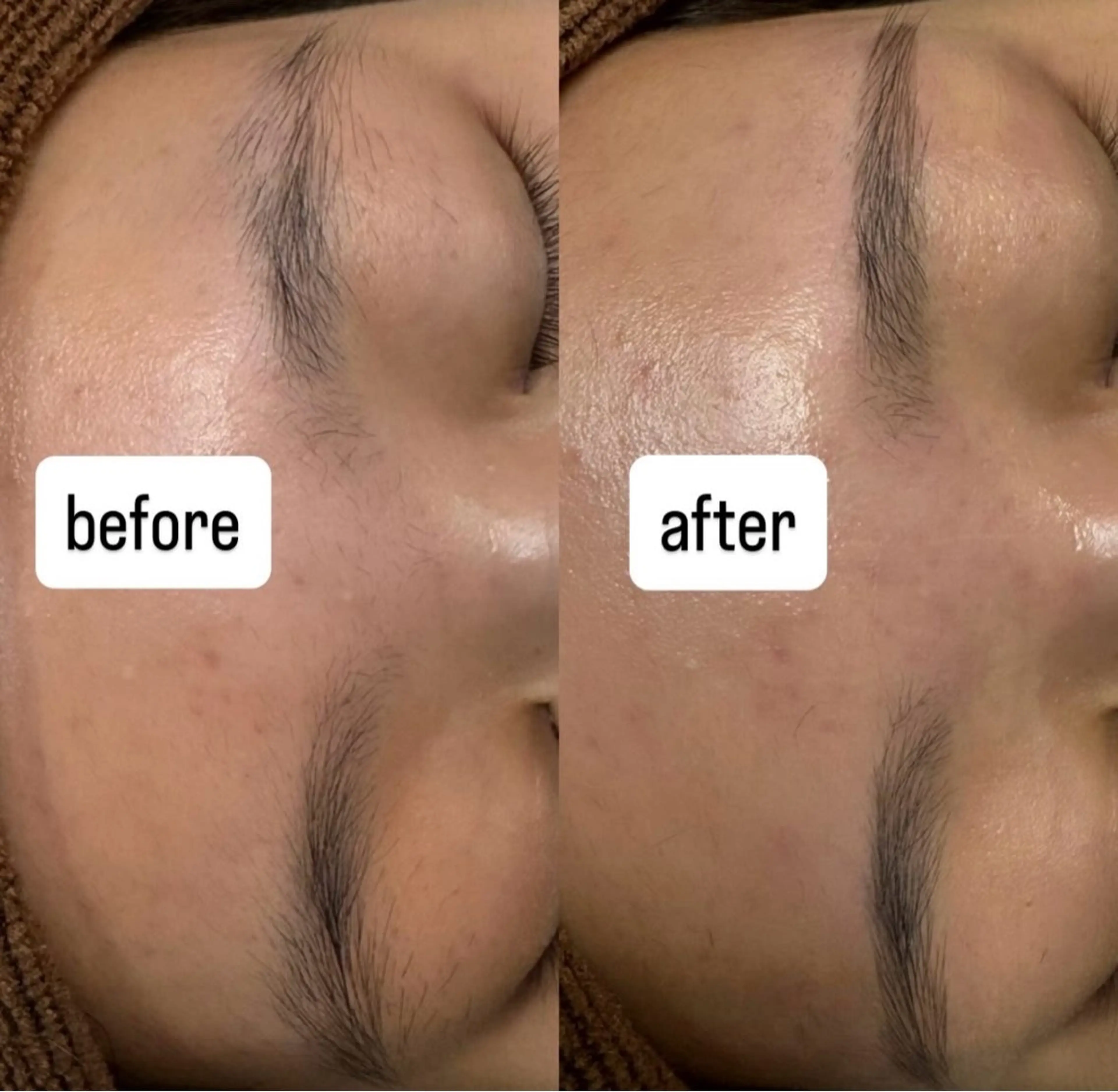 アイブロウ salonvilla所属・villa ☺︎草山 楓花のエステ・リラクイメージ