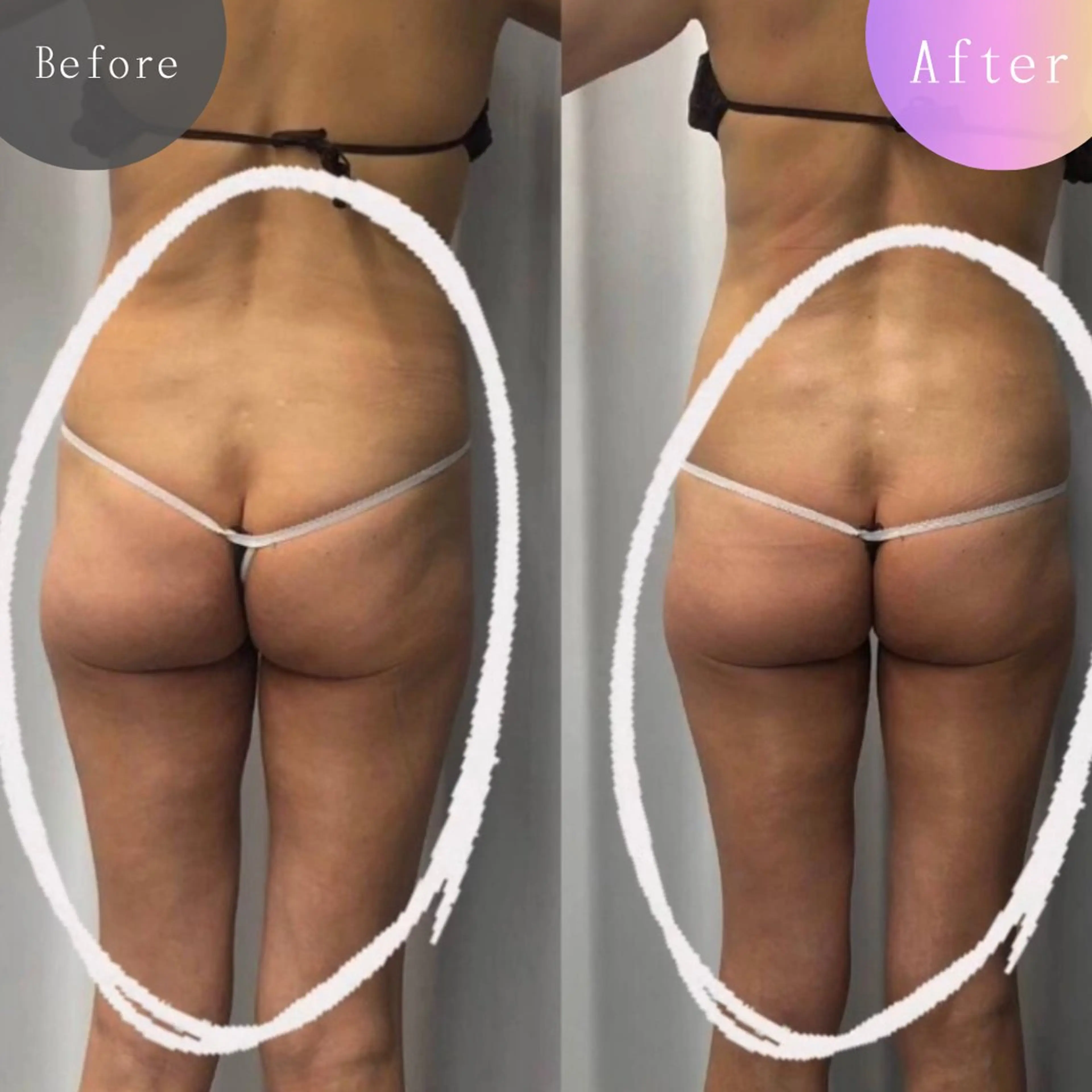 美容整体・塗る漢方・フェイシャルRechica所属・心斎橋痩身 美肌整体サロン💓のエステ・リラクイメージ