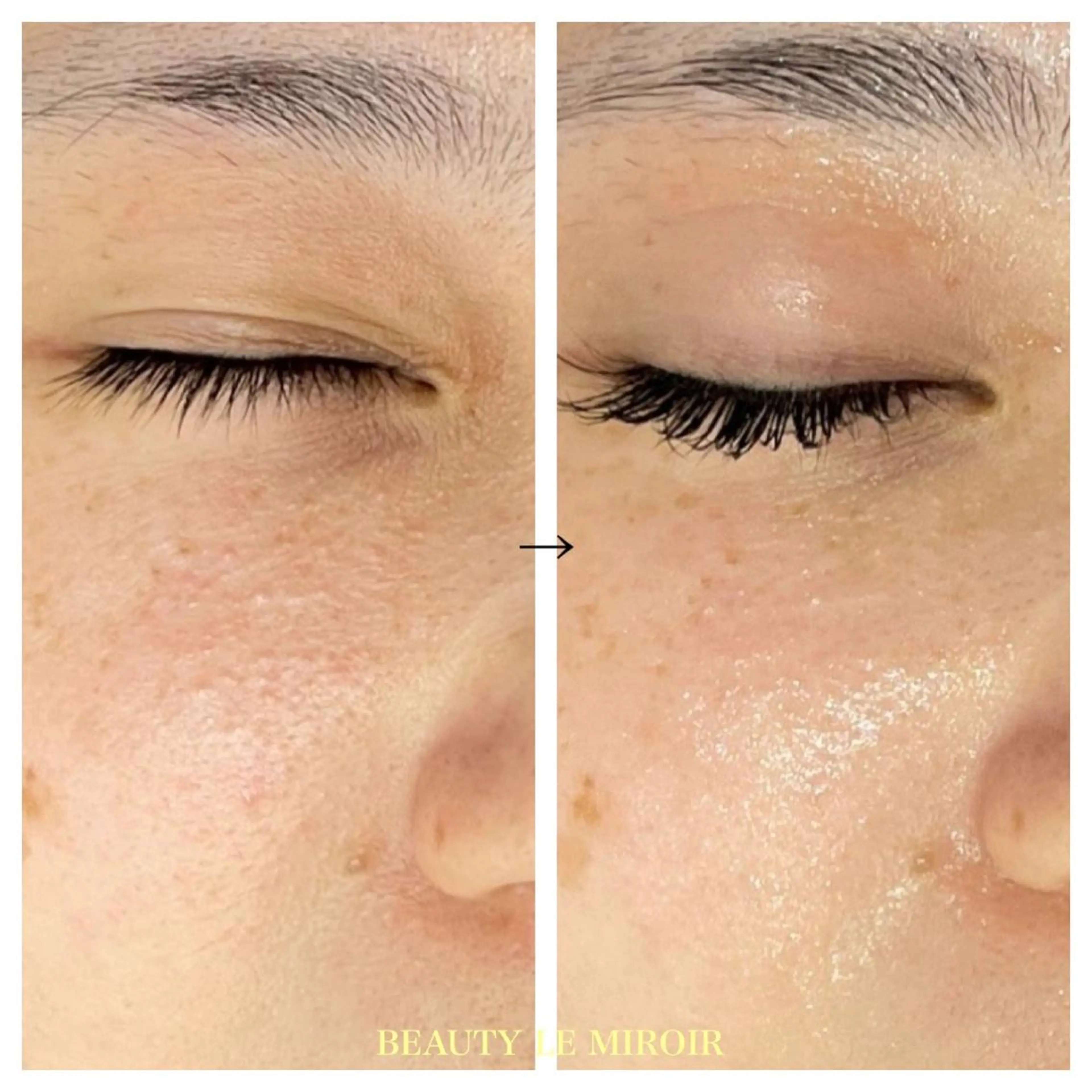 マツエク・マツパ 一重×まつ毛パーマ ビューティー ミロワールのエステ・リラクイメージ