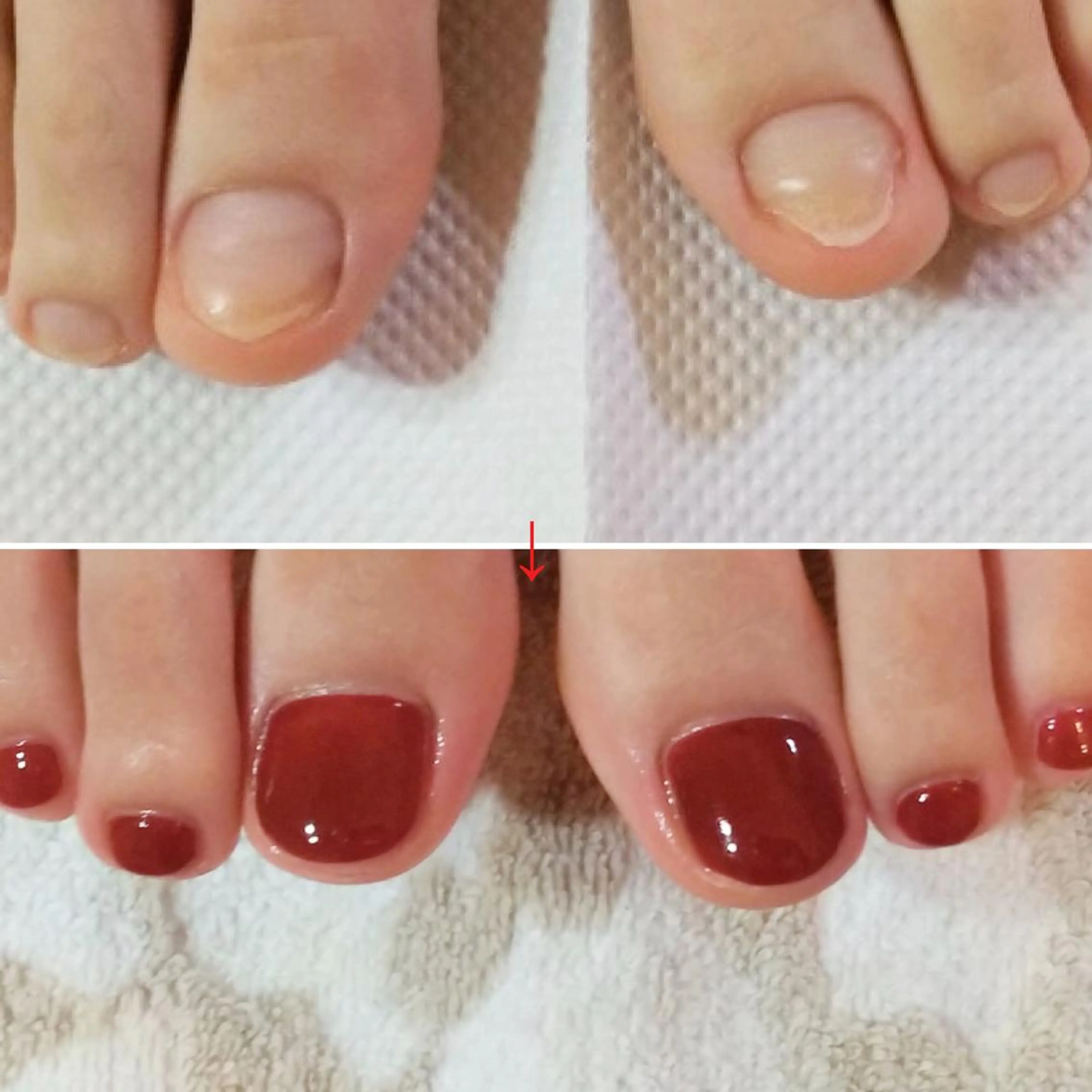 ネイル フットネイル ネイルサロンアリューム所属・ネイルサロン アリュームのネイルデザイン