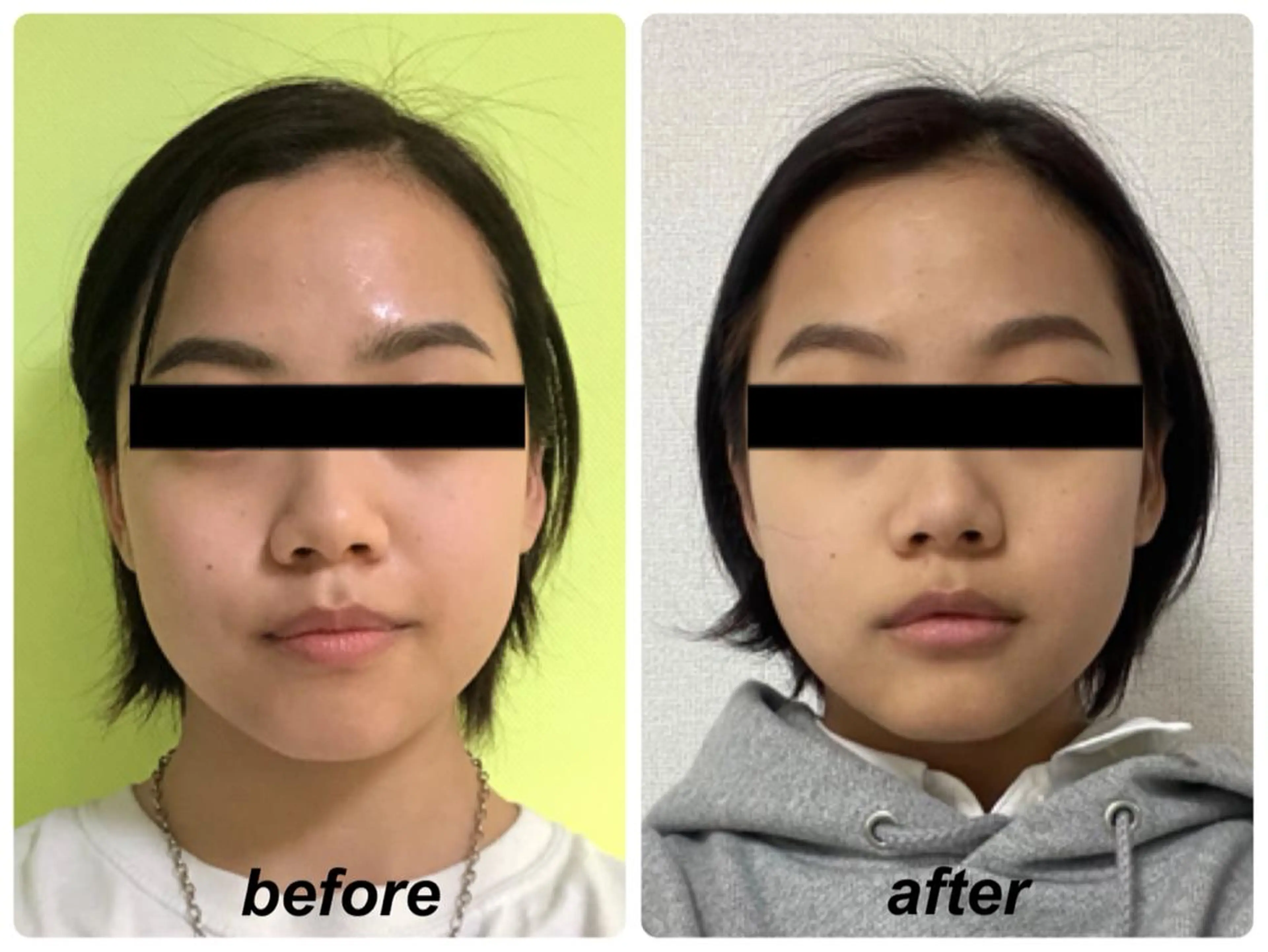 Radiance H.Oのエステ・リラクイメージ