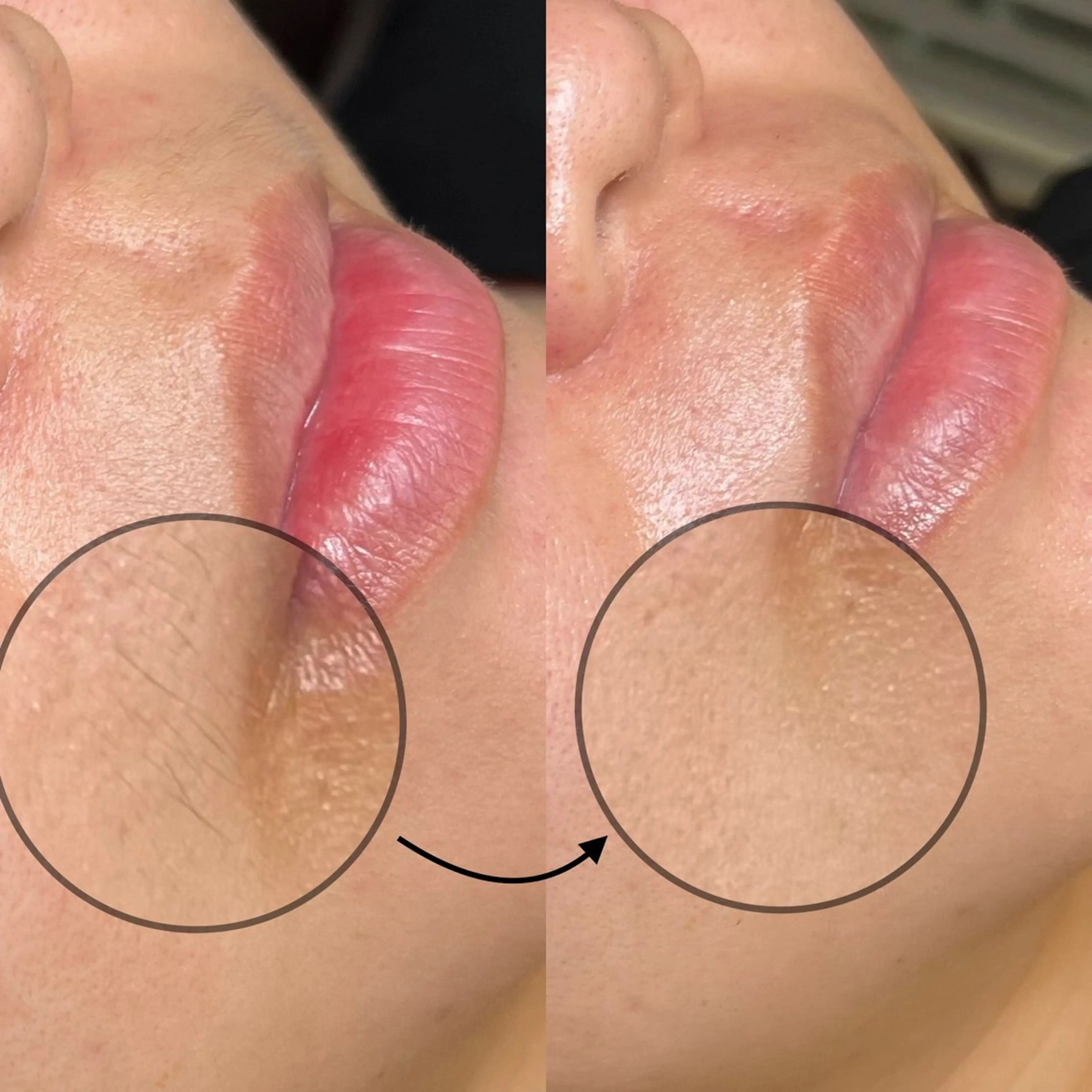 脱毛 Cherie Kawaguchiのマツエク・マツパデザイン