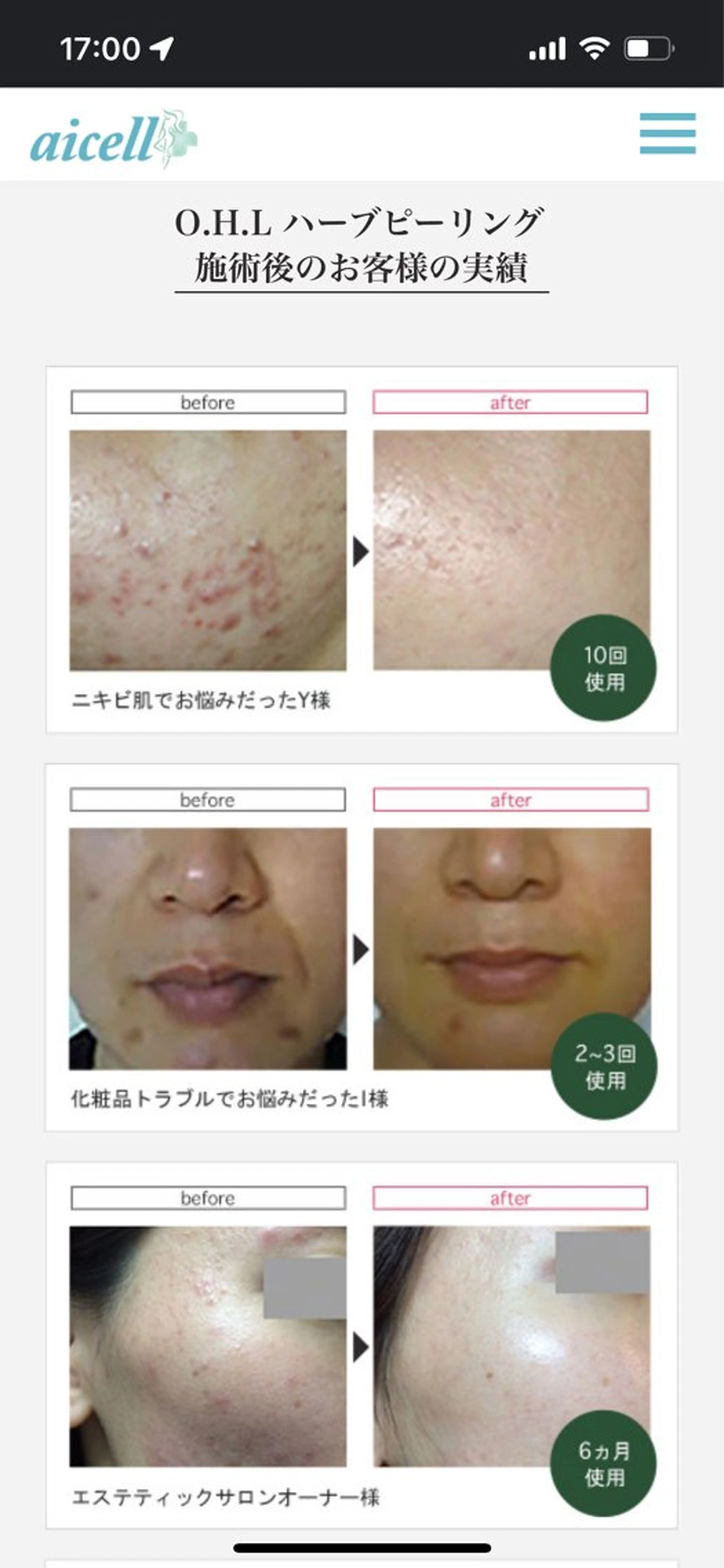 肌質改善 ルポエトワのエステ・リラクイメージ