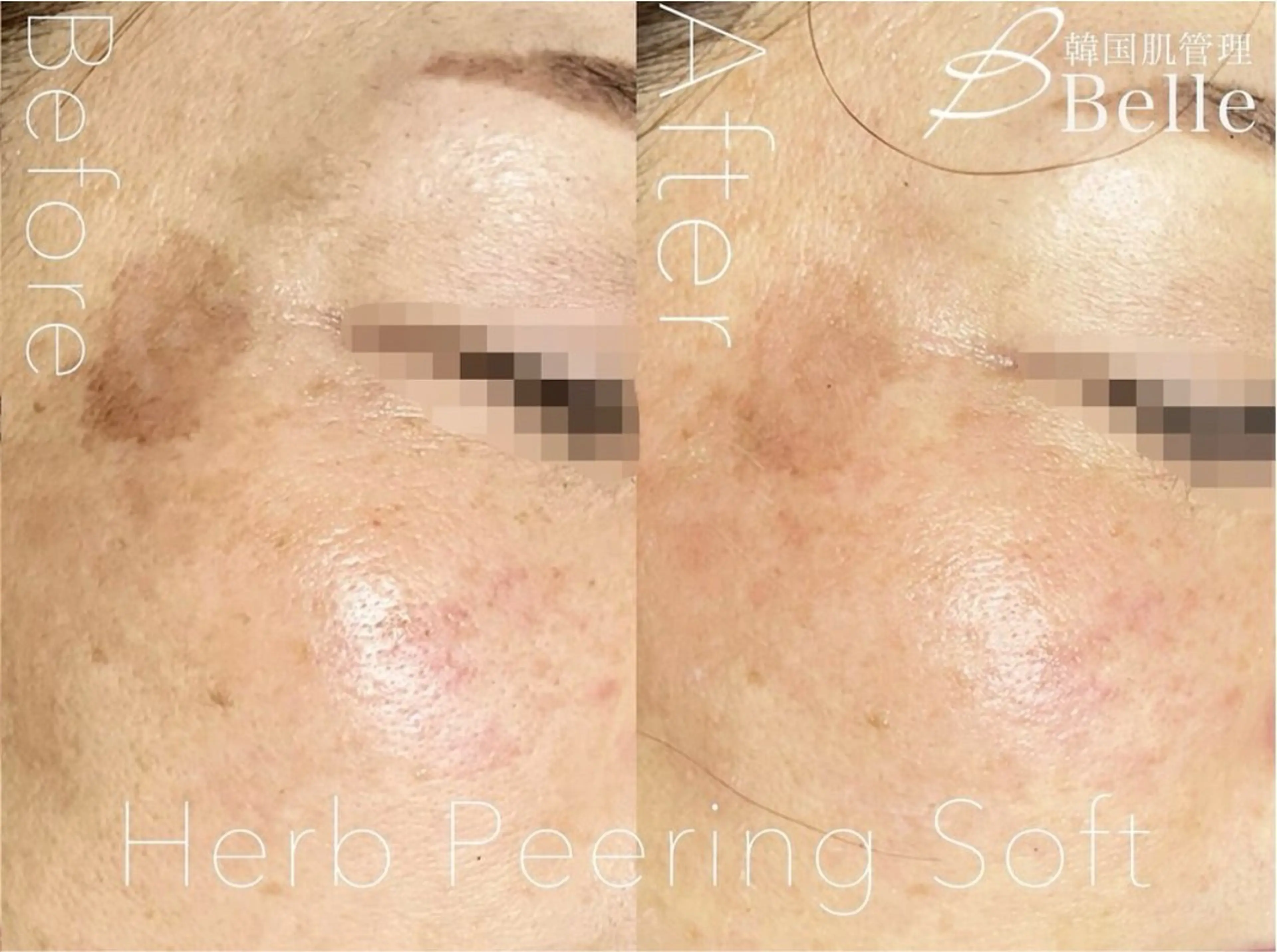 森 Belle目黒のエステ・リラクイメージ