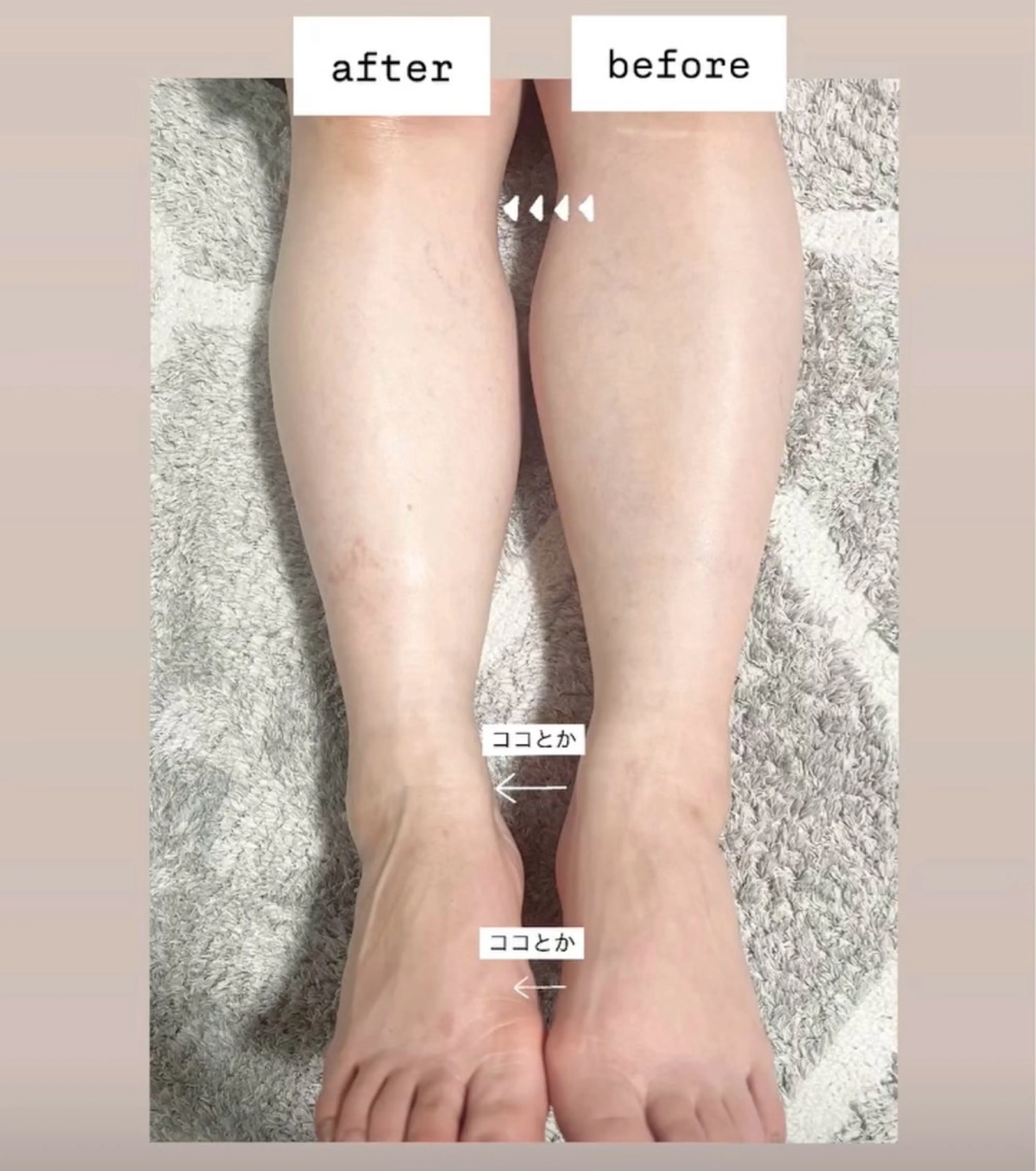 BODYオイルトリートメント60分の写真