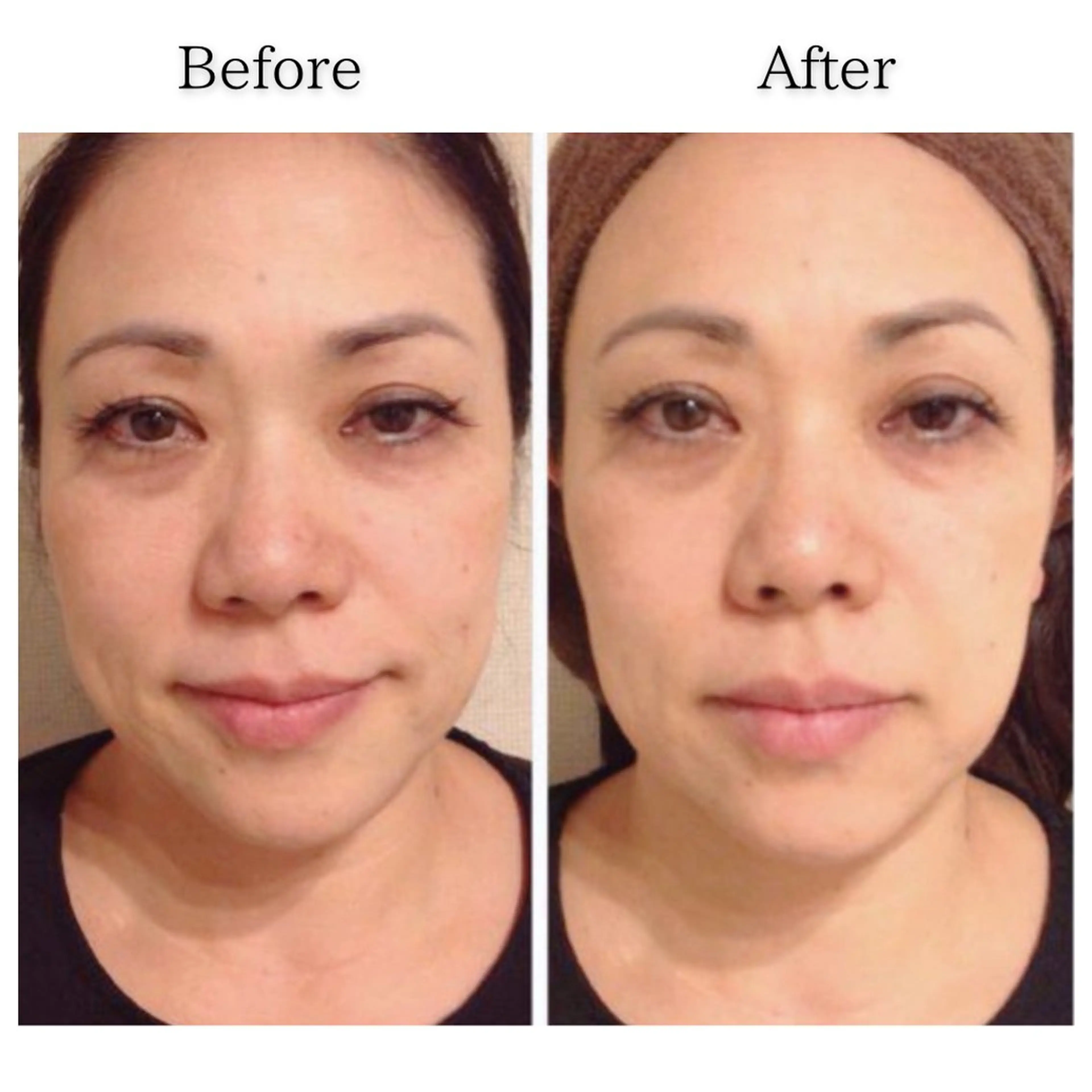 その他 SELF  BEAUTY gracia浦添店所属・gracia 浦添店のその他イメージ