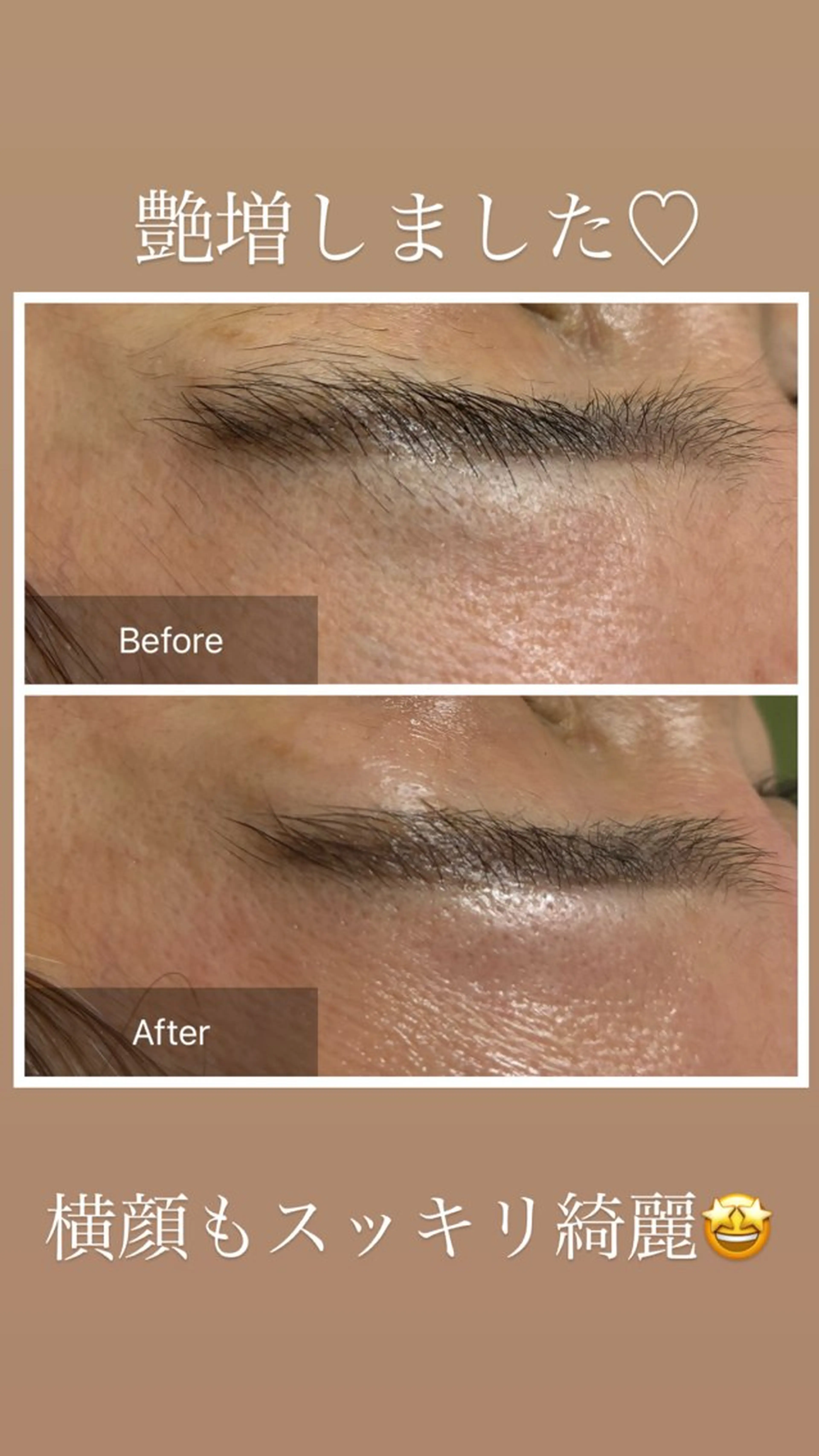 産毛専門店 Bittoのエステ・リラクイメージ