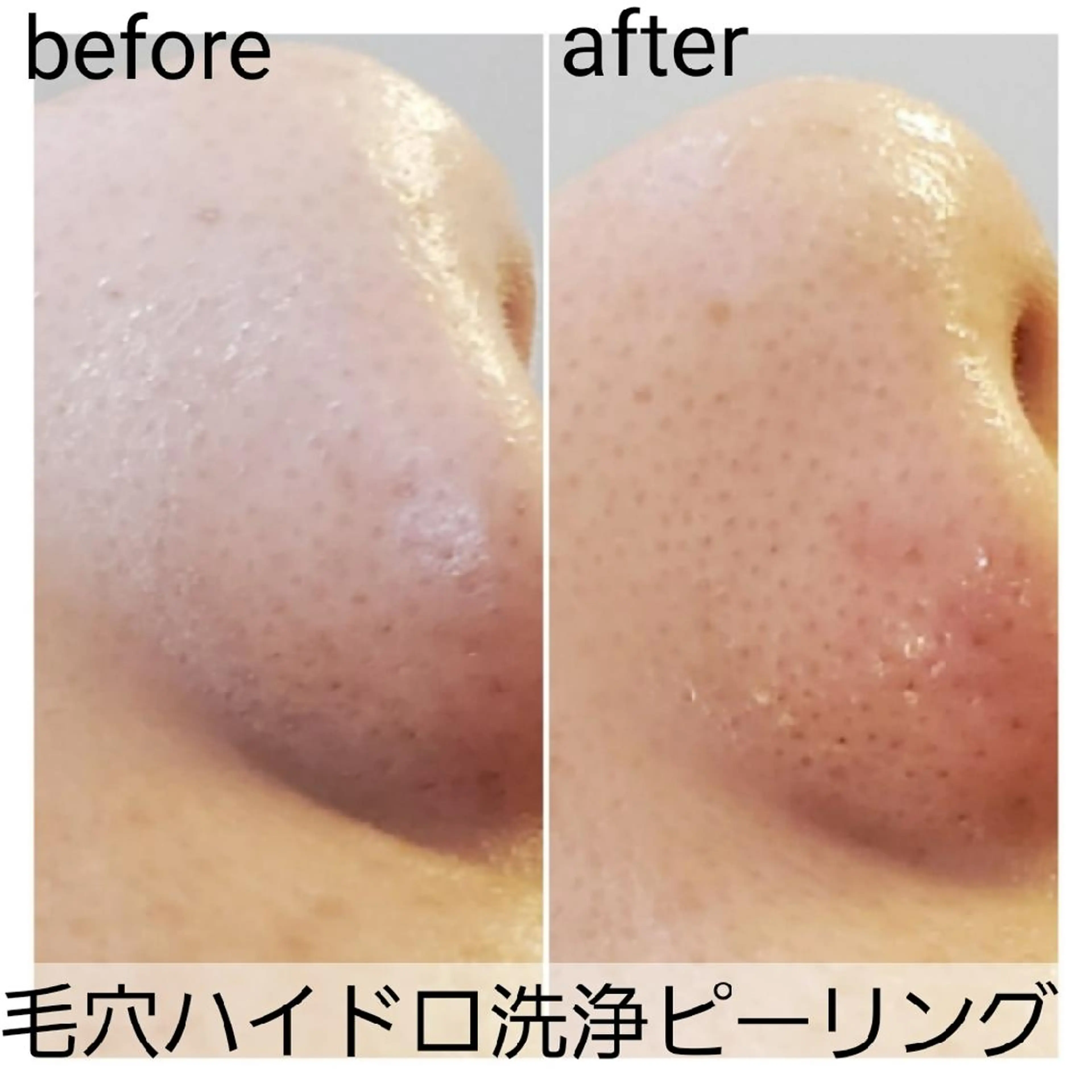 メンズ 小顔・美肌ケア専門 Diva北浜のエステ・リラクイメージ