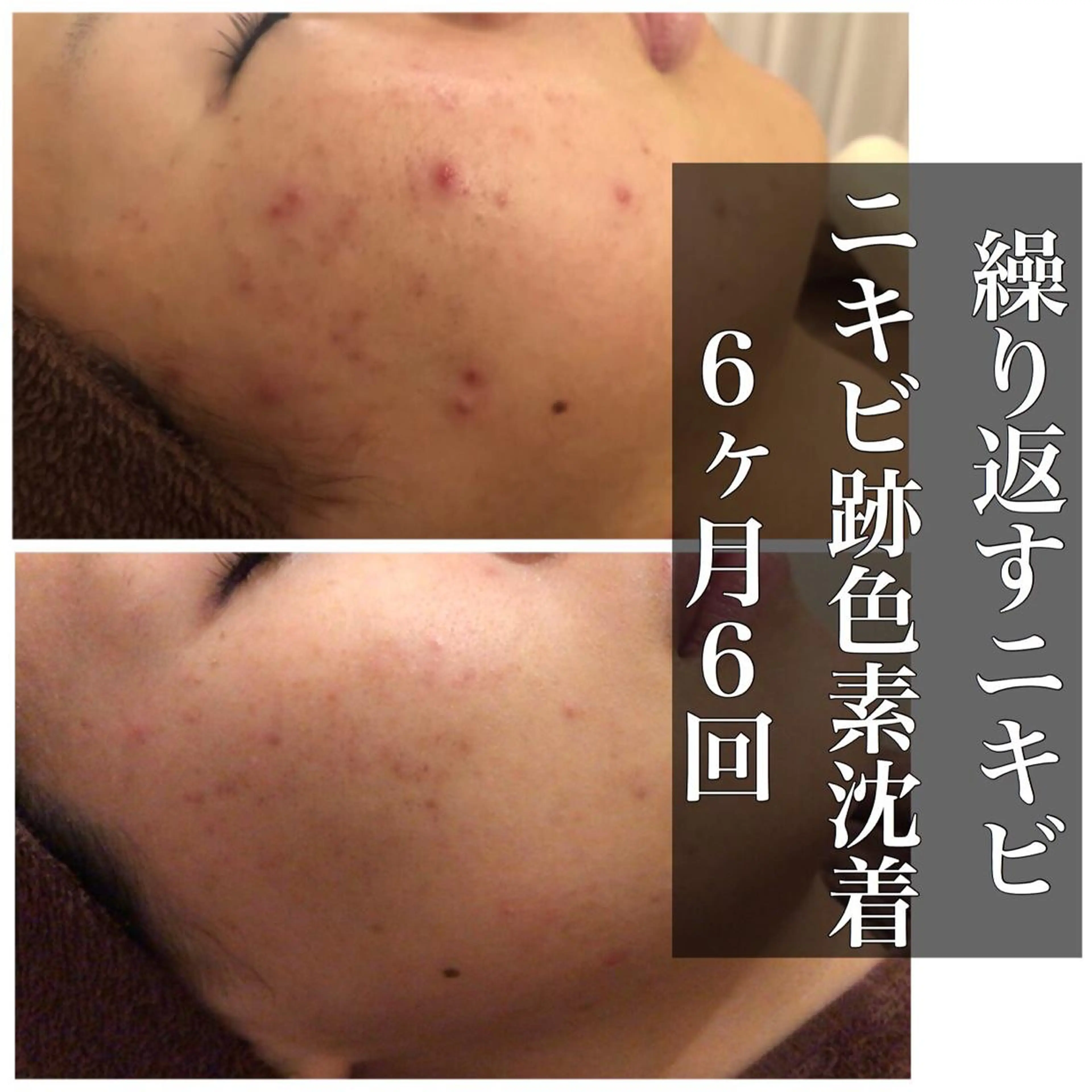 ミディアム カラー パーマ ヘアアレンジ メンズ キッズ ネイル マツエク・マツパ エステ リラク ニキビ・肌質改善専門 ♡人生が変わるサロンのエステ・リラクイメージ