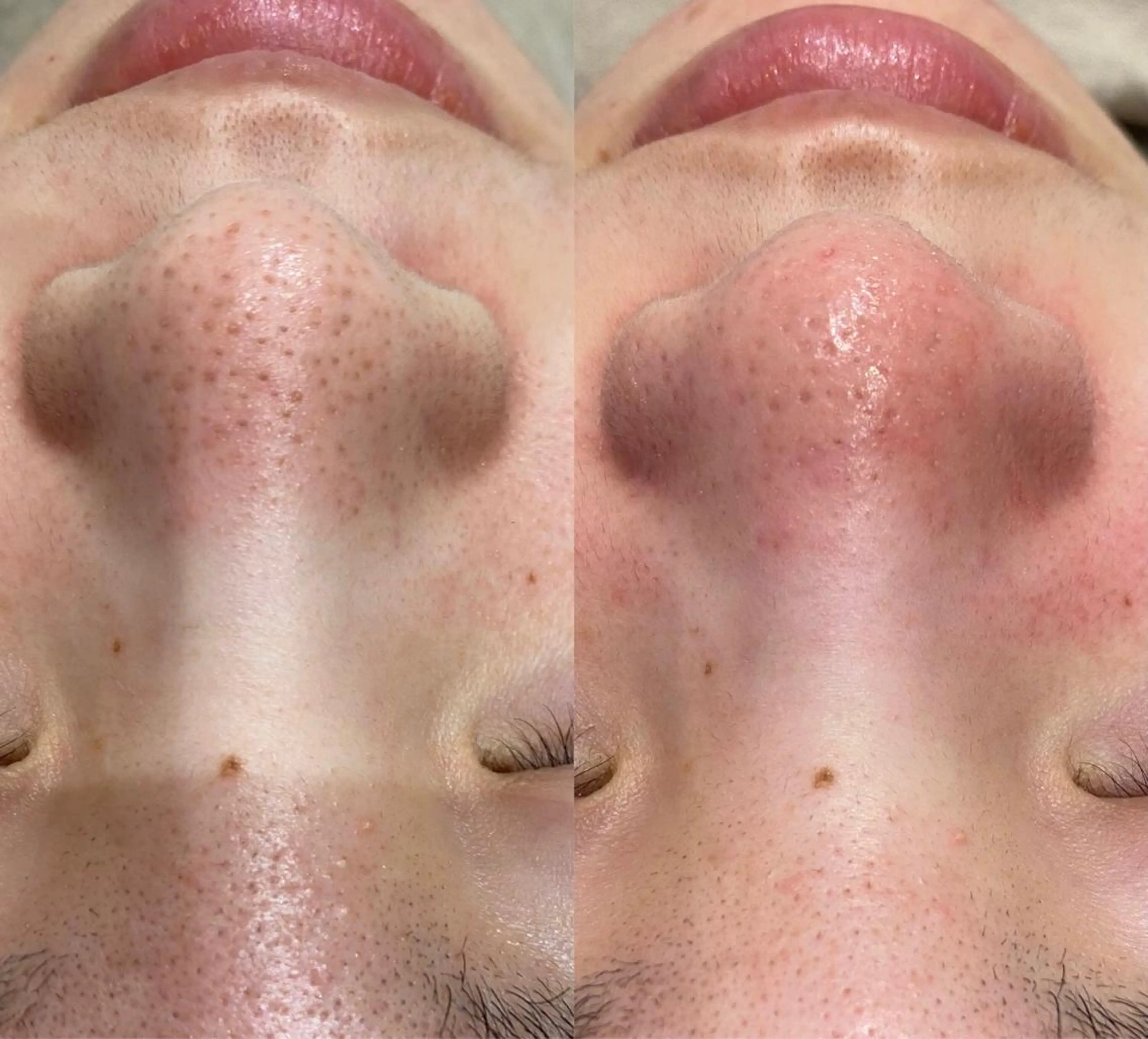 エステ Sii センター北のエステ・リラクイメージ