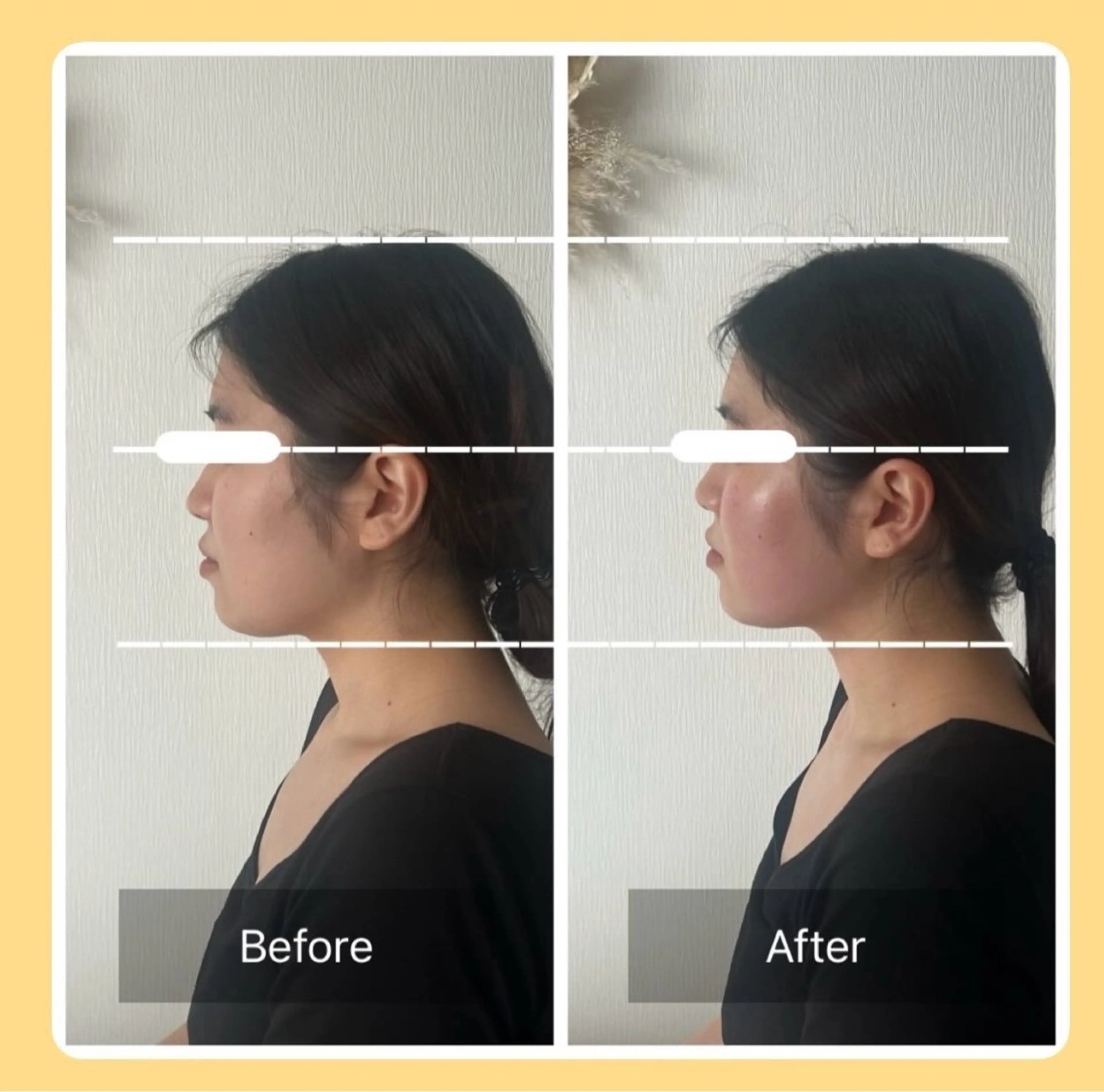 MeguruSalon所属・山口 颯希のエステ・リラクイメージ