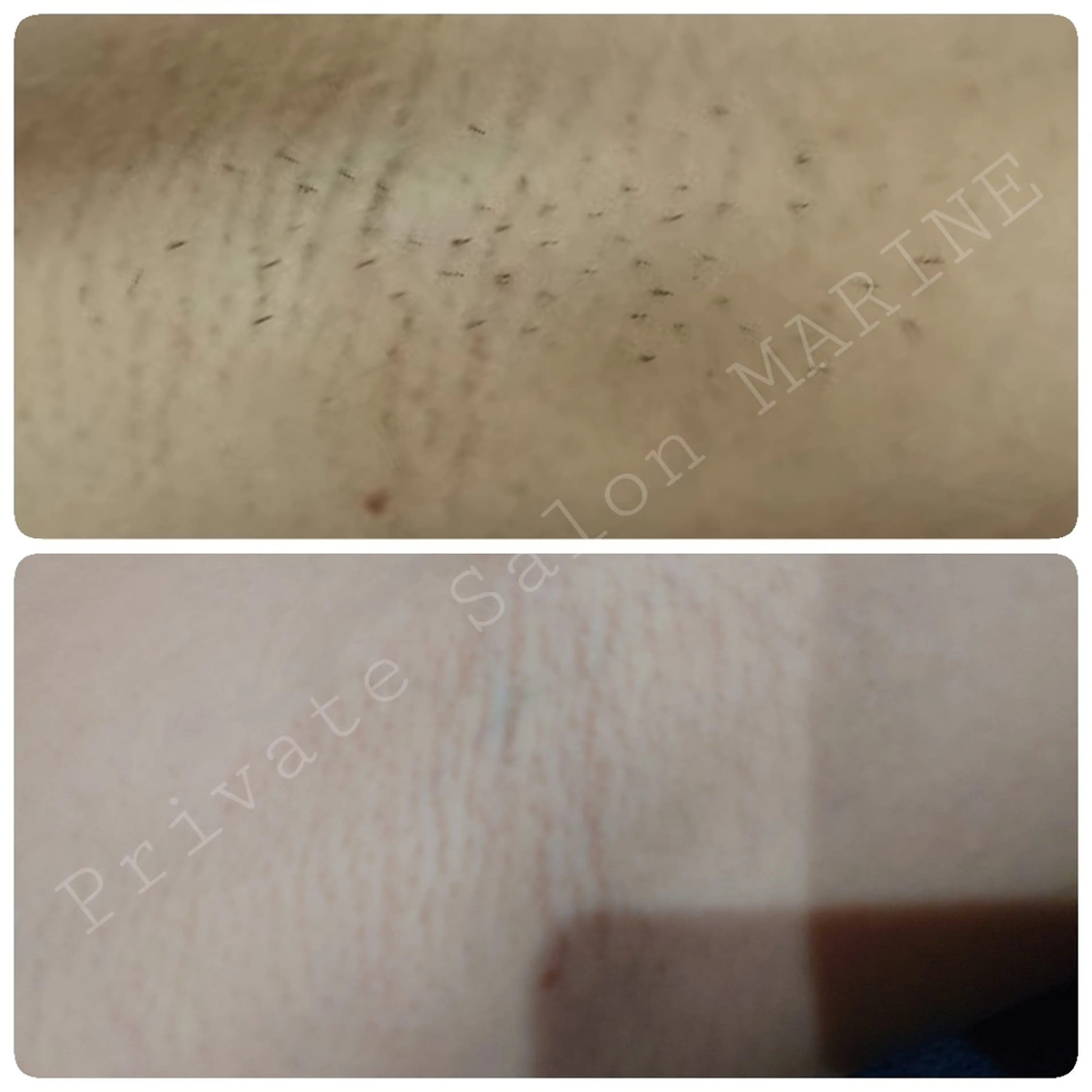 プライベートサロンマリン所属・Private Sa lon MARINEのエステ・リラクイメージ