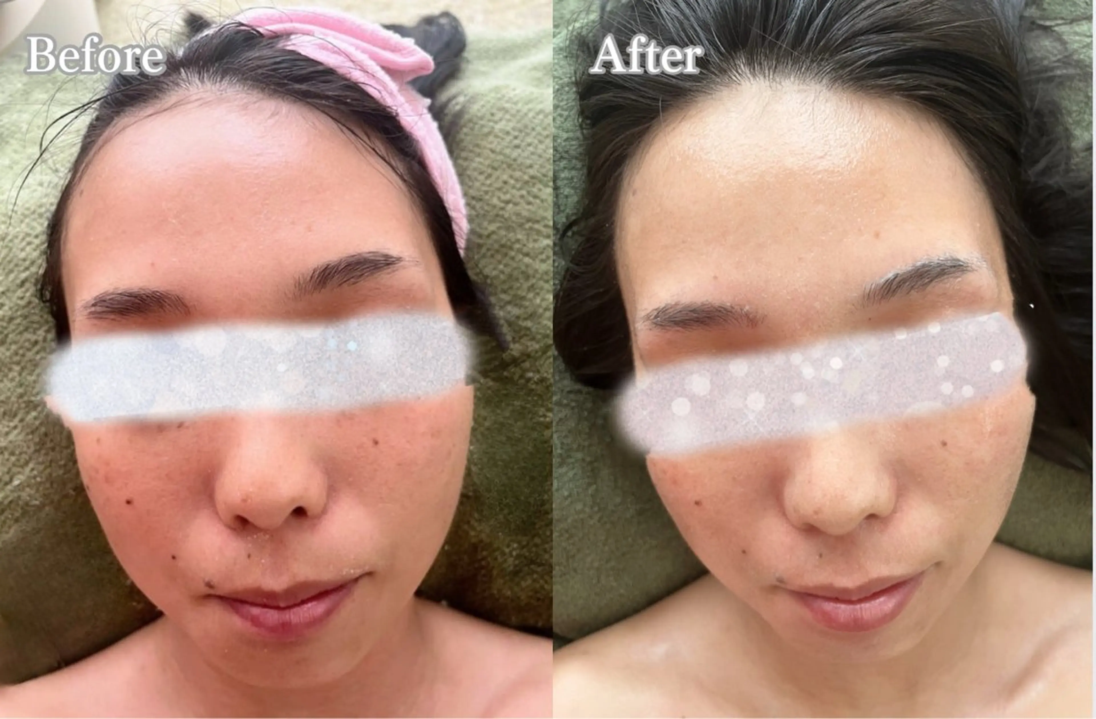 エステ リラク facial salon D 吉沢のエステ・リラクイメージ