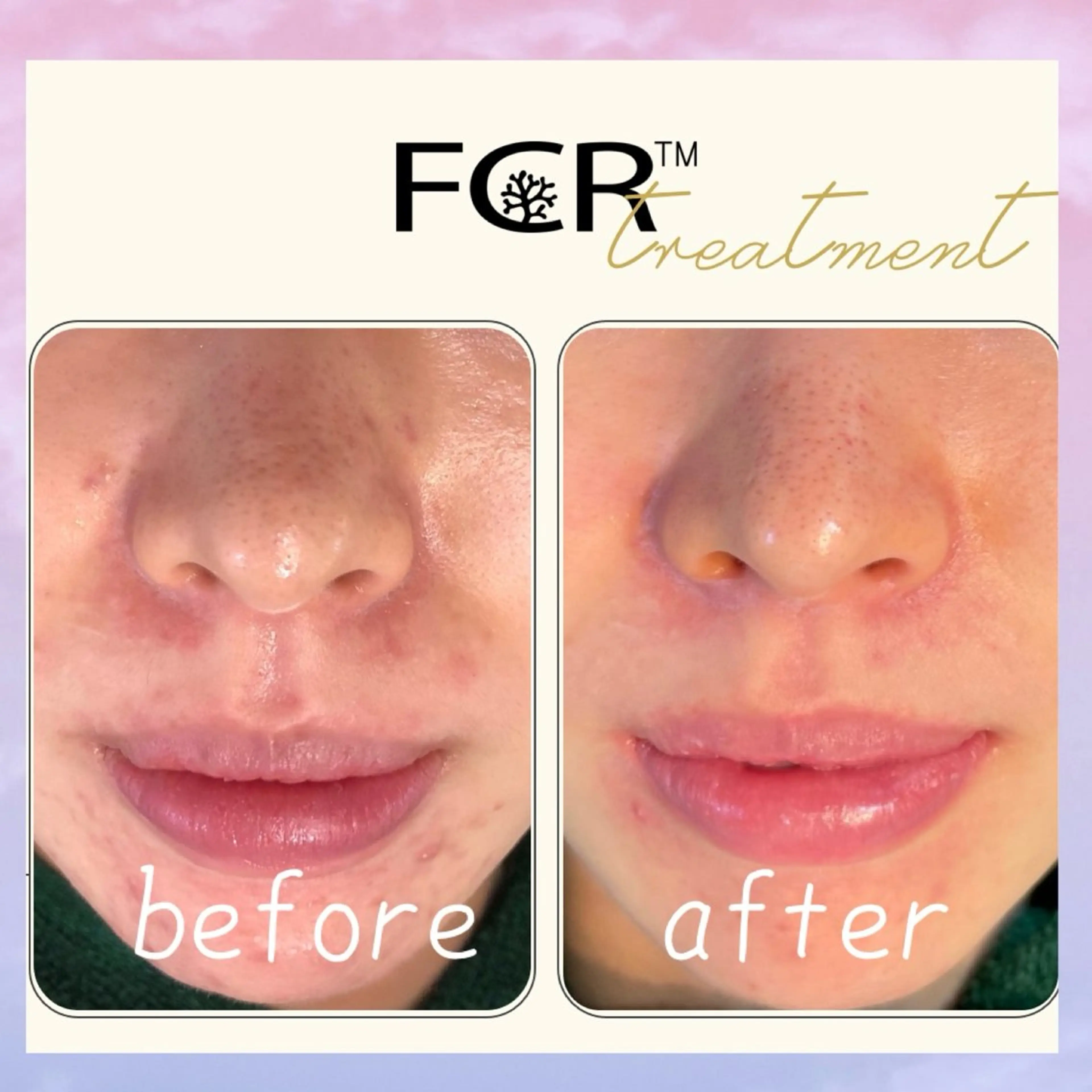 肌質改善Charme coco 増毛のエステ・リラクイメージ