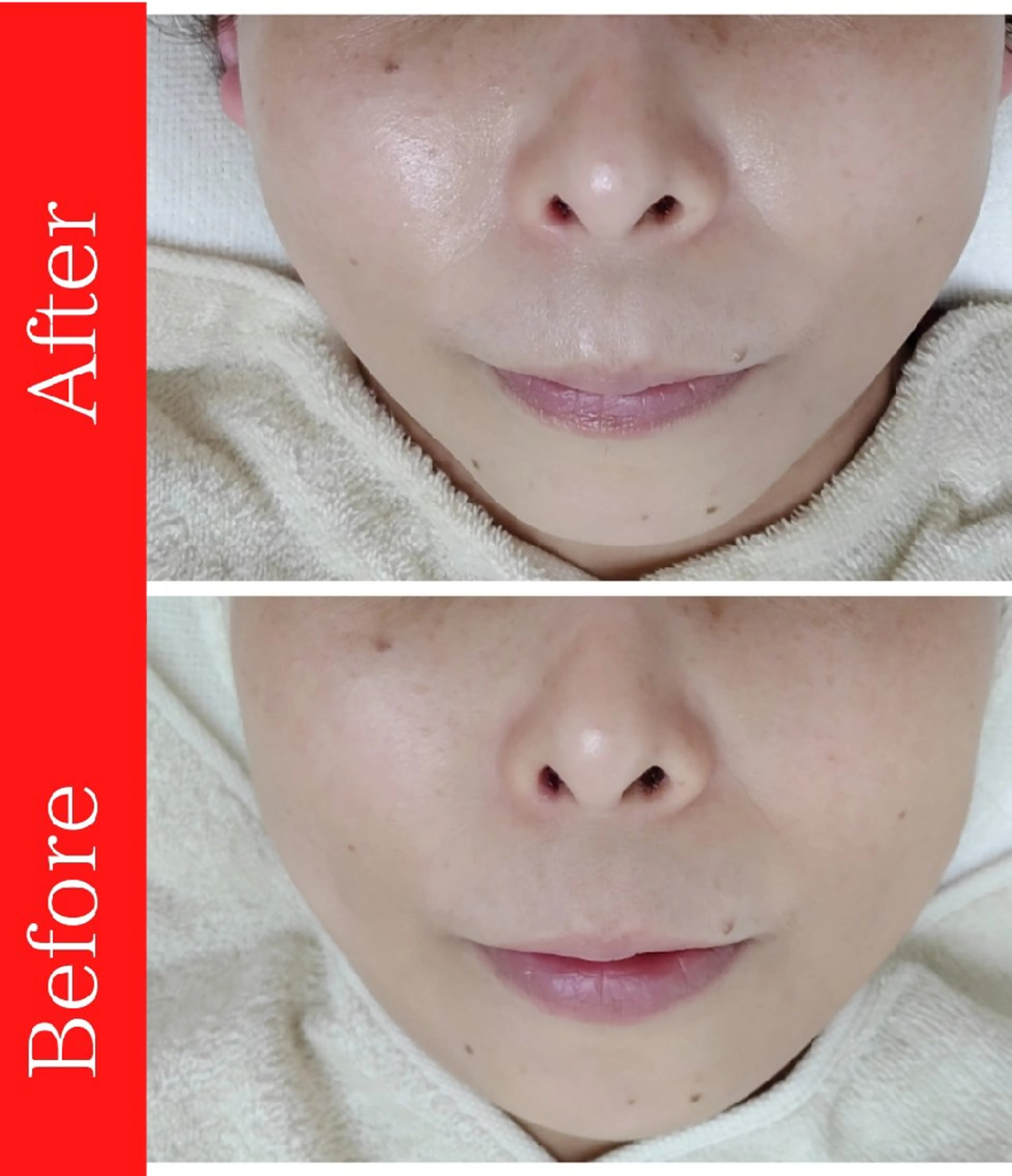 ユニセックスエステサロンUniclear所属・痩身&フェイシャル Uniclearのエステ・リラクイメージ