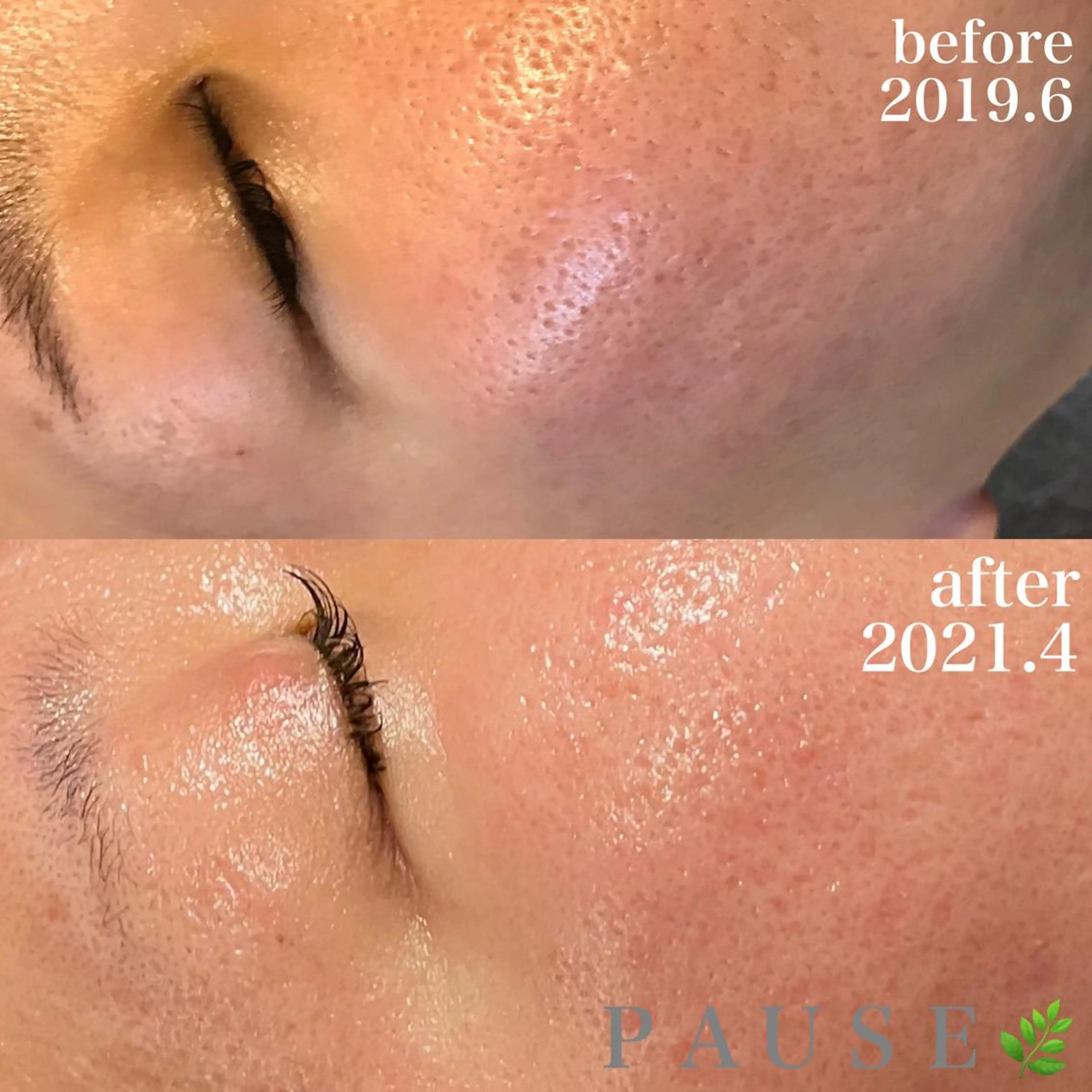 エステ 浜野 恵美のエステ・リラクイメージ