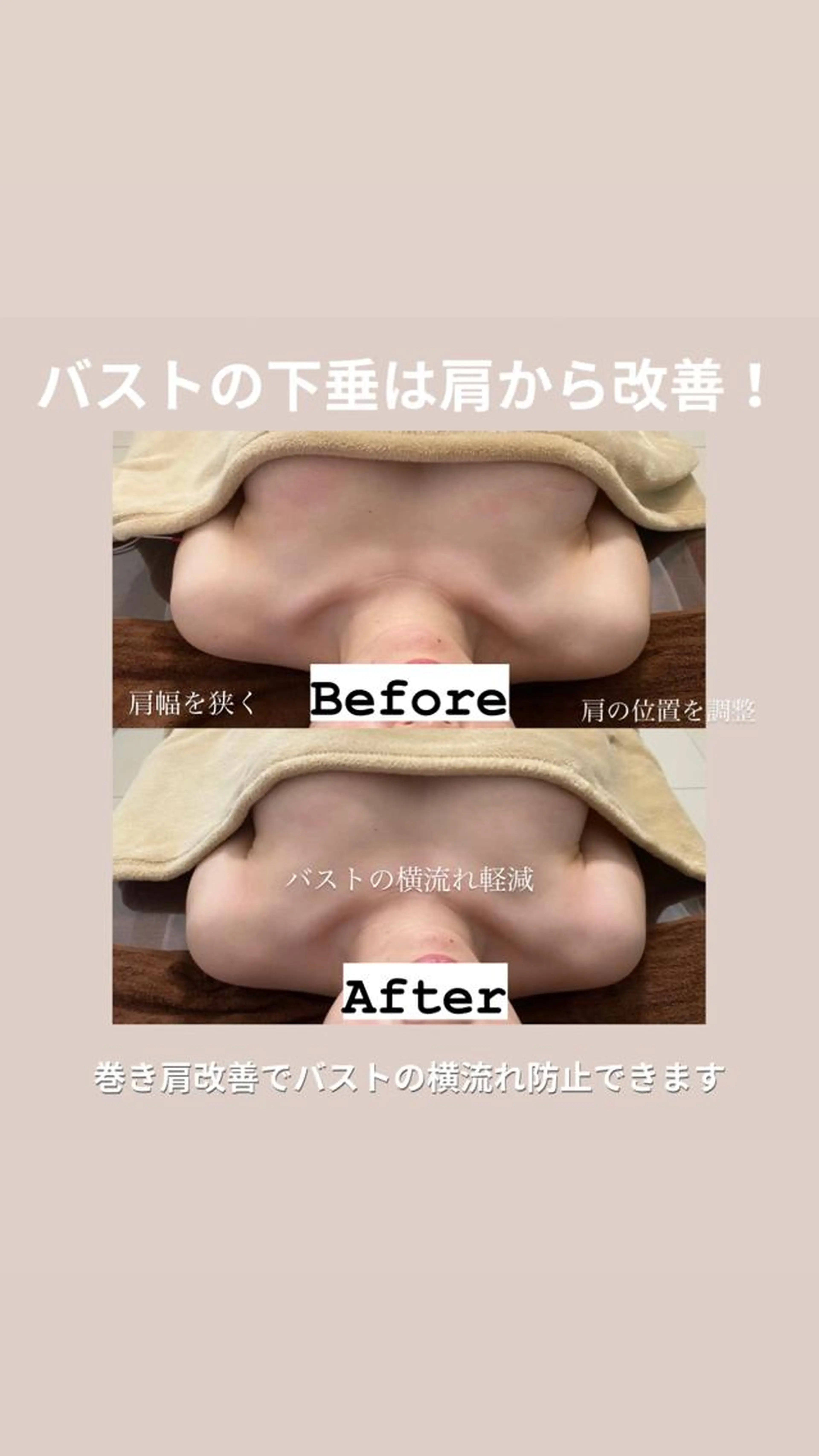 人気NO.2⭐️下垂・ハリ・巻き肩・猫背にお悩みの方⭐️効果実感度99%！全てのバスト悩み改善◎の写真