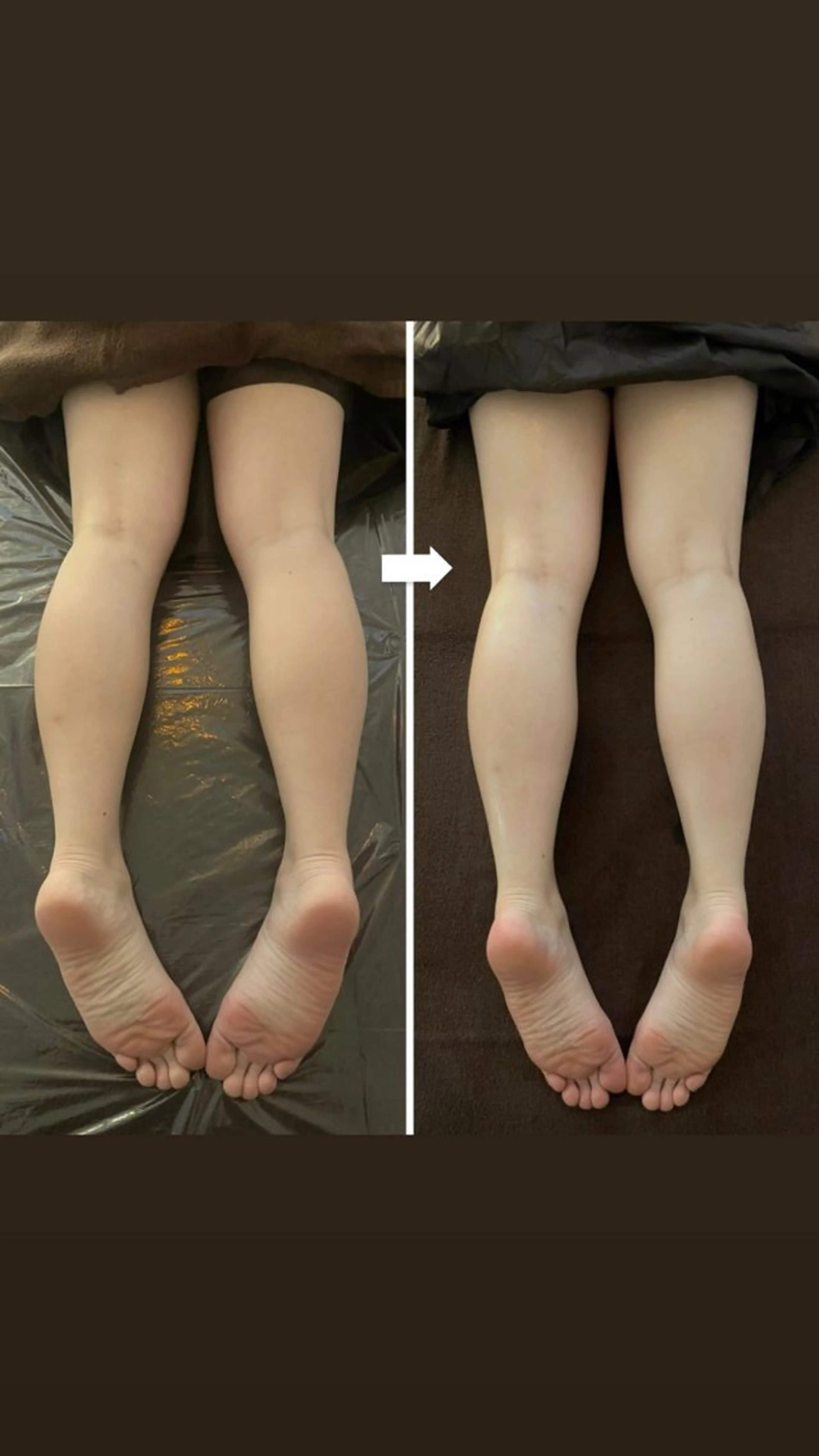 下半身のむくみ・重だるさを緩和したい方におすすめ【強めの圧でオイルトリートメント】６０分の写真