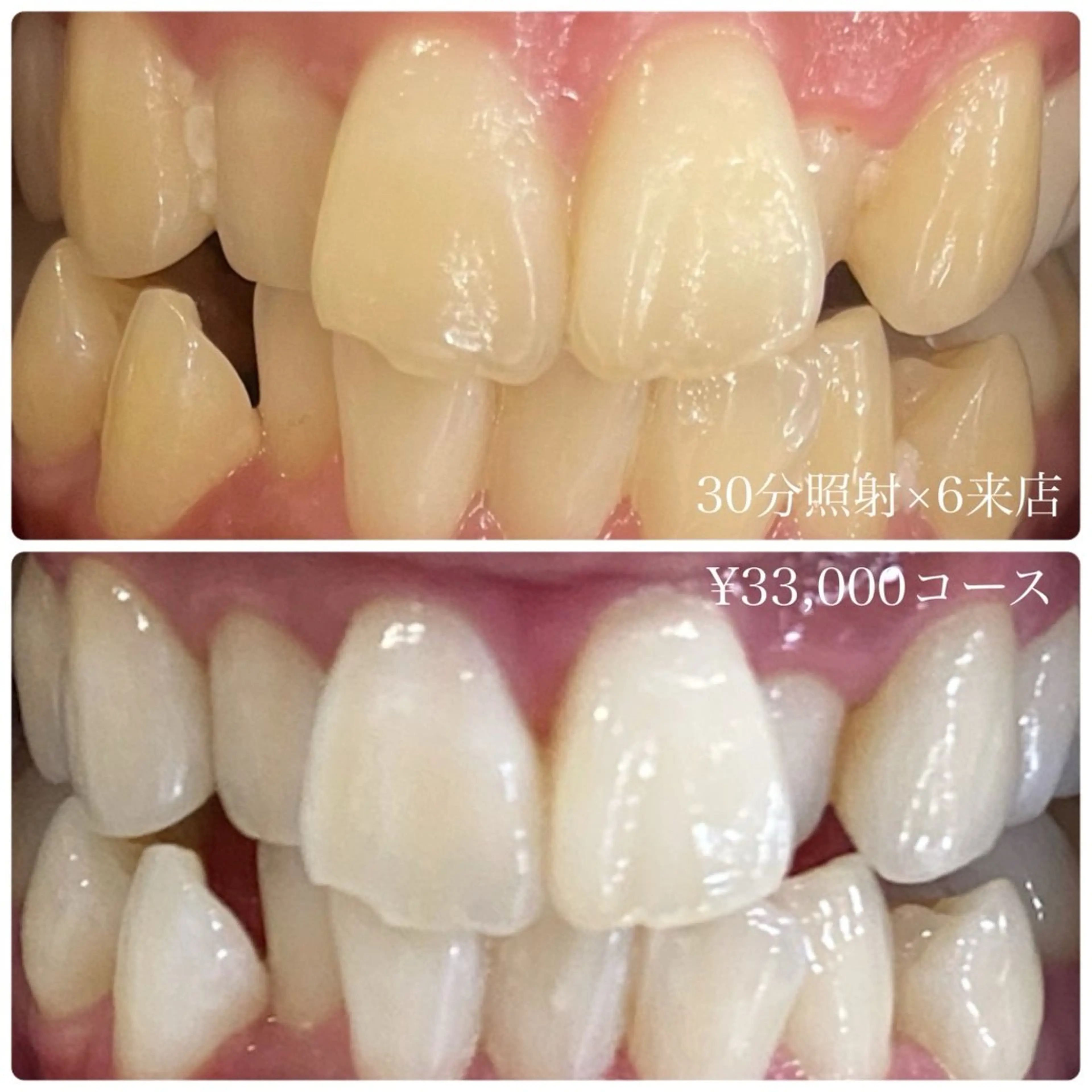 その他 PLATINUM Beauty 横浜店所属・ホワイトニングルーム 横浜店のその他イメージ