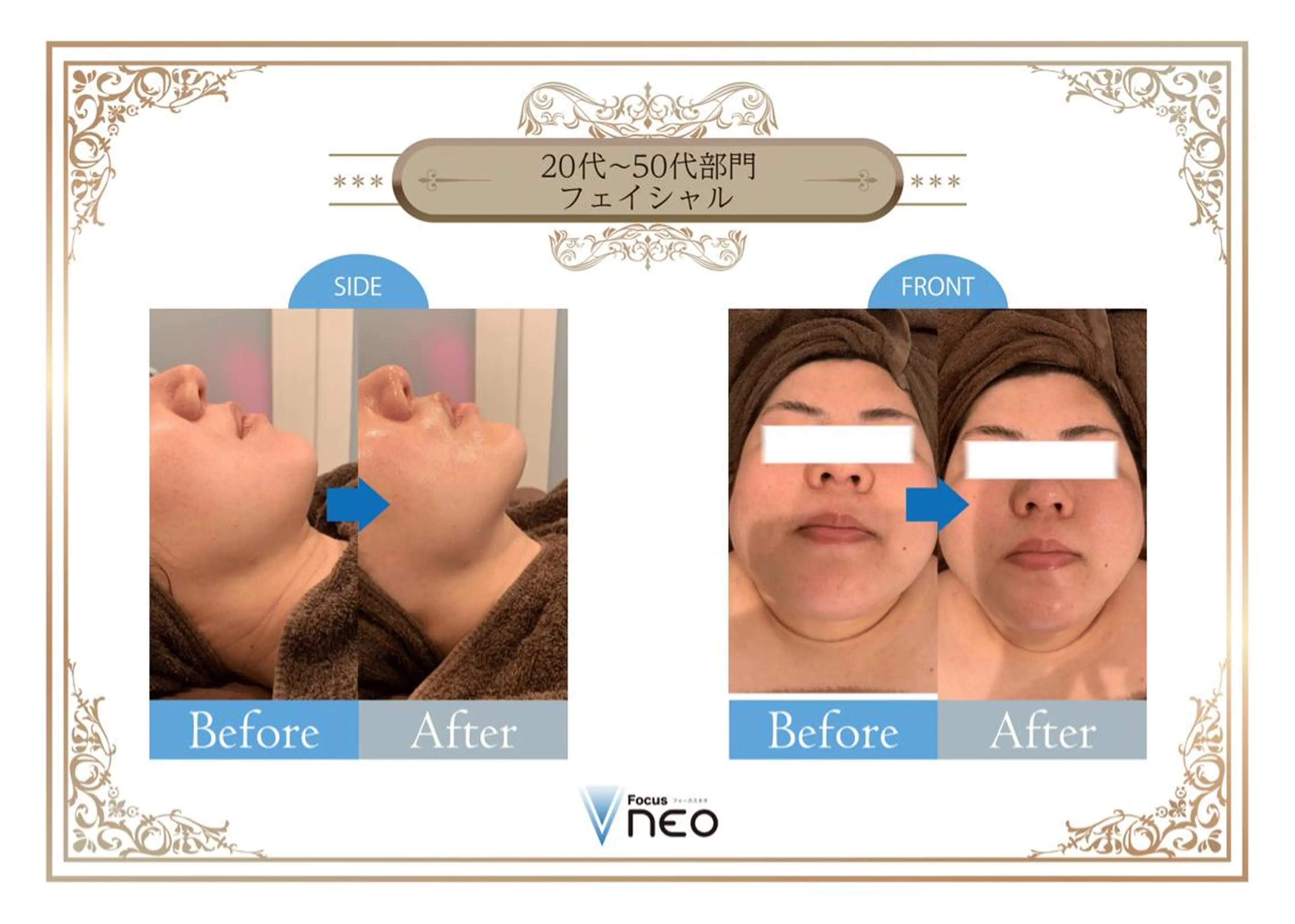 エステ 毛穴/肌質改善サロン クレアベレッツァのエステ・リラクイメージ