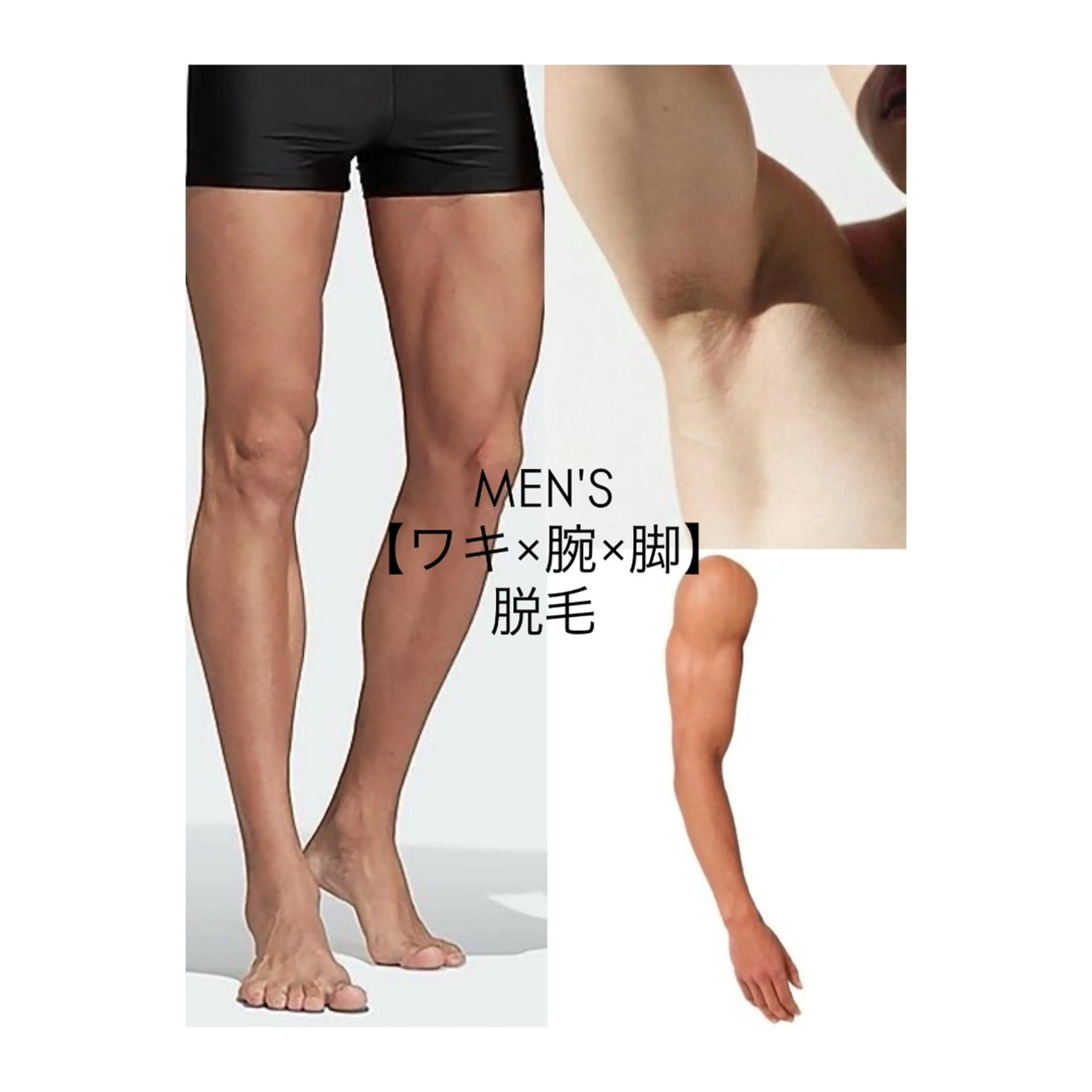 【見える部分重視＆清潔感】人気パーツ◆高性能美肌脱毛◆スピード脱毛◆ほぼ痛みナシ◆メンズ◆腕・脚・ワキ脱毛の写真