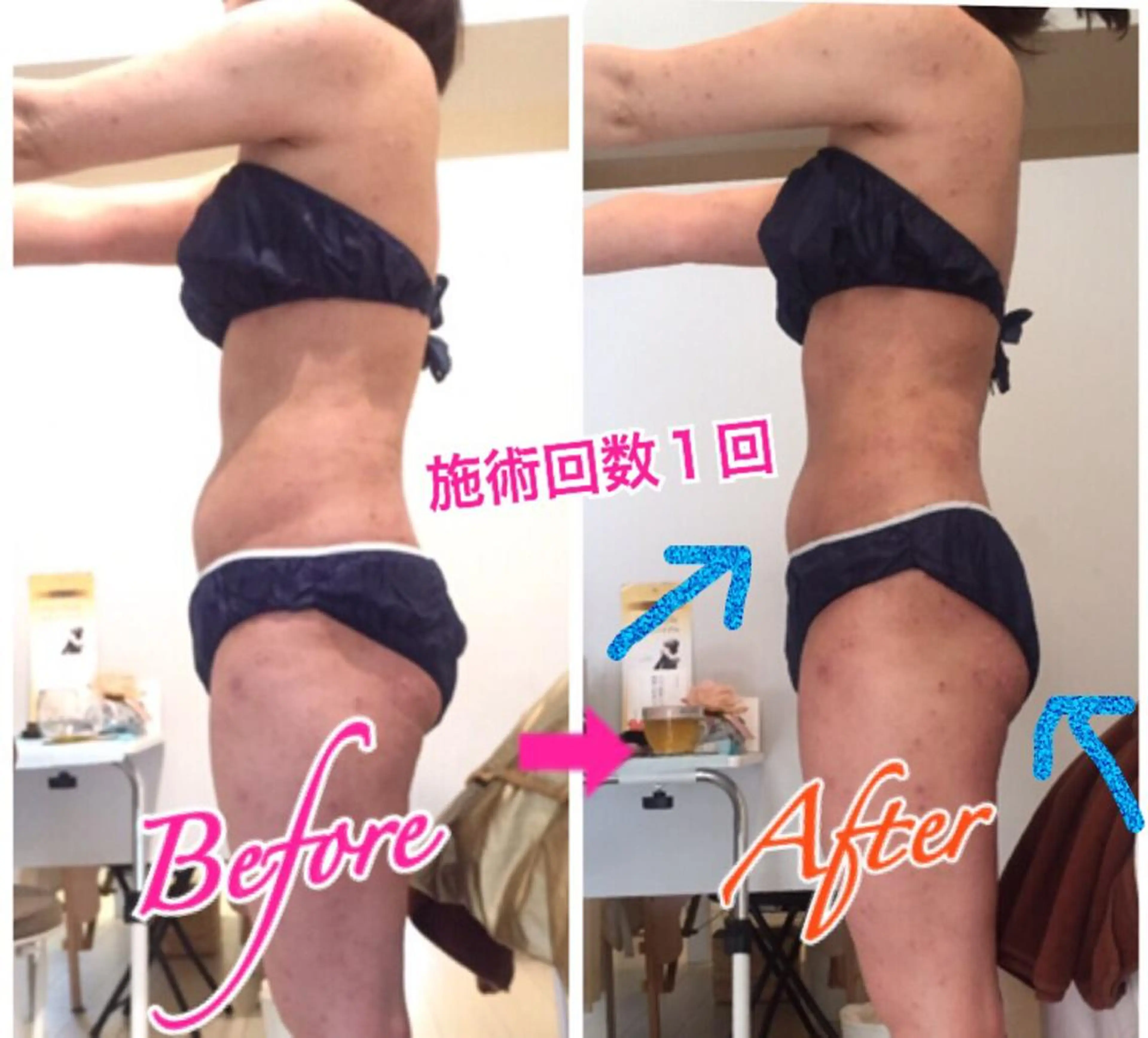 ミディアム カラー パーマ ヘアアレンジ メンズ キッズ ネイル マツエク・マツパ ‍痩身＆ボディ 結果出し🌟丹野のエステ・リラクイメージ