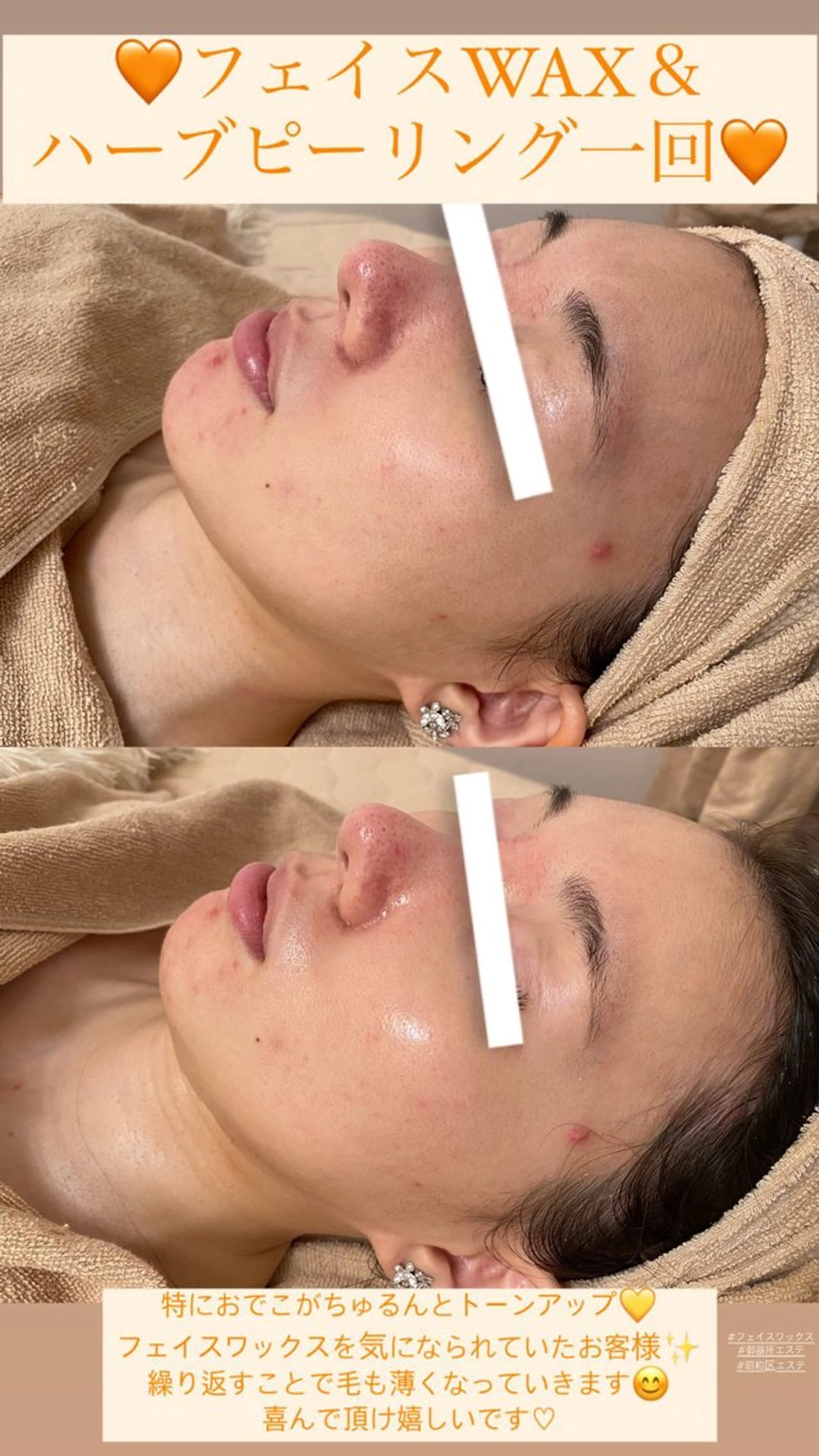 メンズ エステ Salon de Lino 御器所のエステ・リラクイメージ