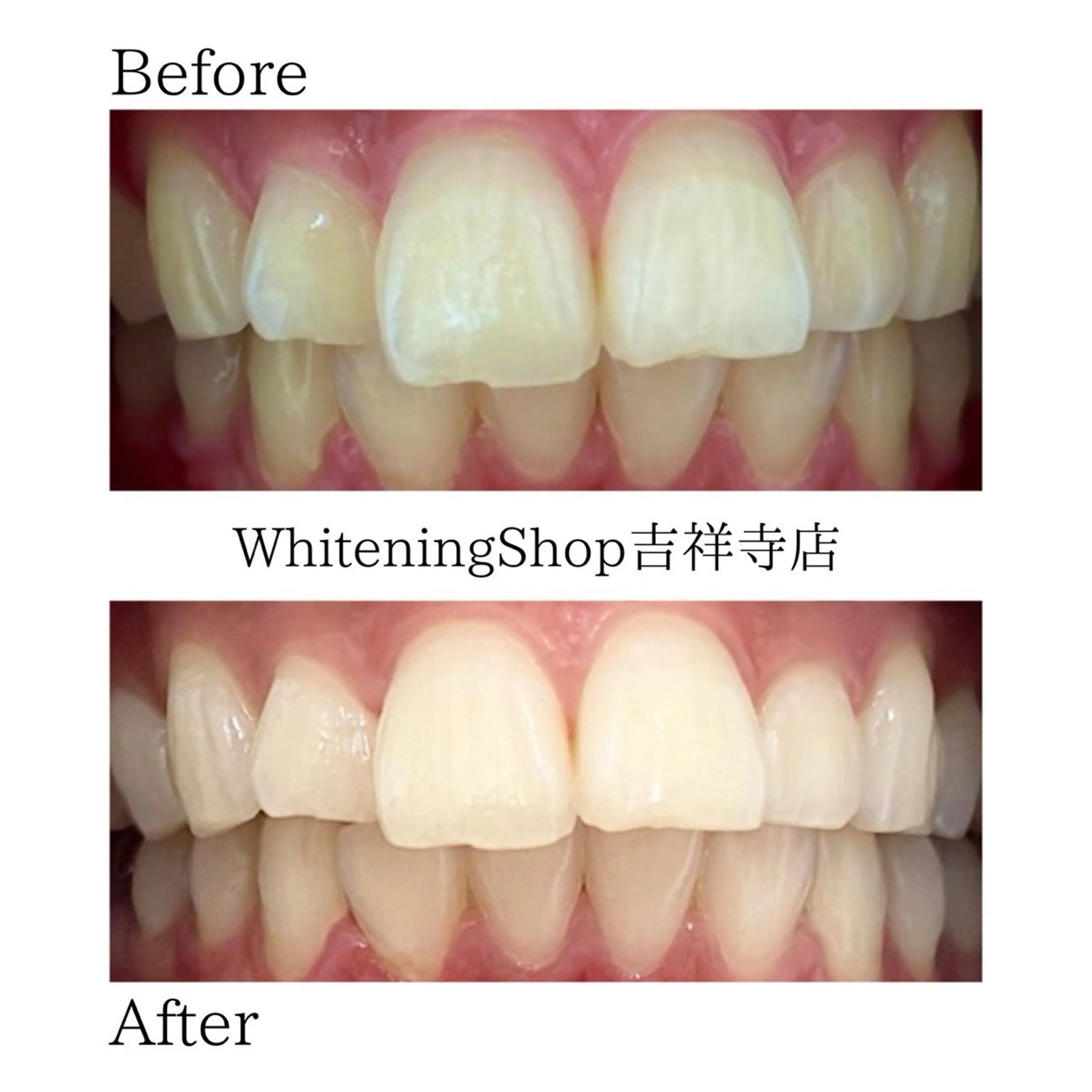 エステ リラク ホワイトニング ショップ吉祥寺店のエステ・リラクイメージ