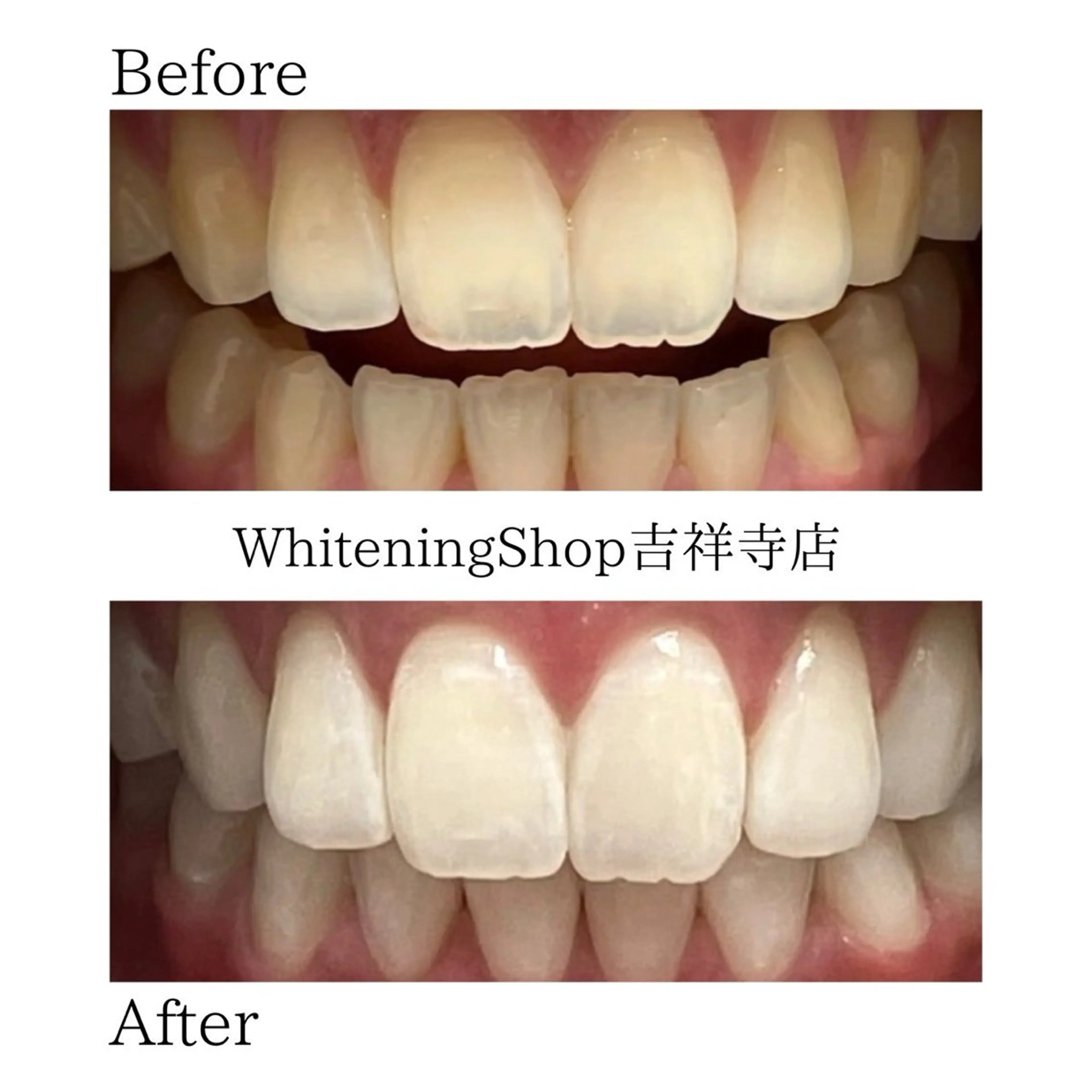 エステ リラク ホワイトニング ショップ吉祥寺店のエステ・リラクイメージ