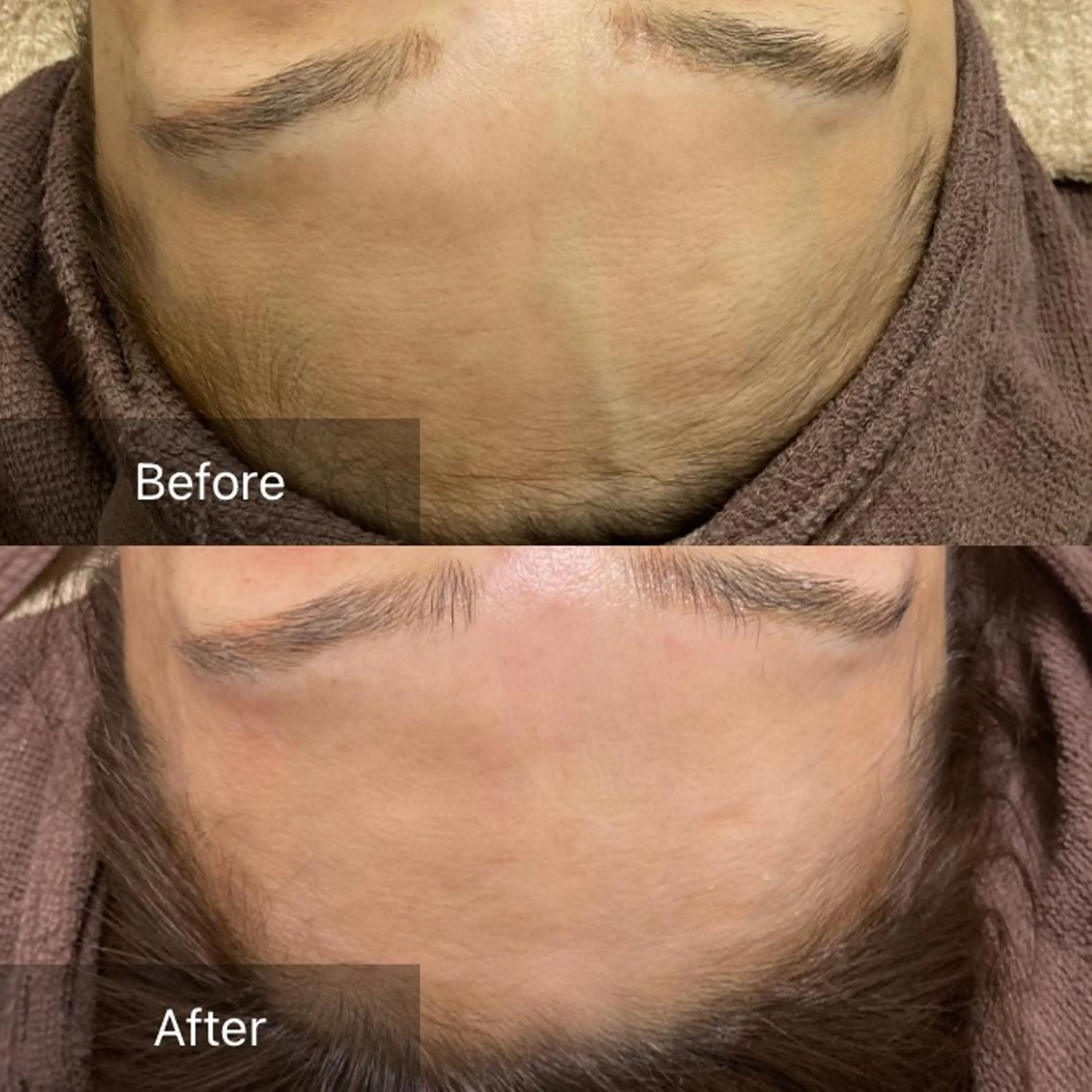 脱毛 産毛専門店 Bittoのエステ・リラクイメージ