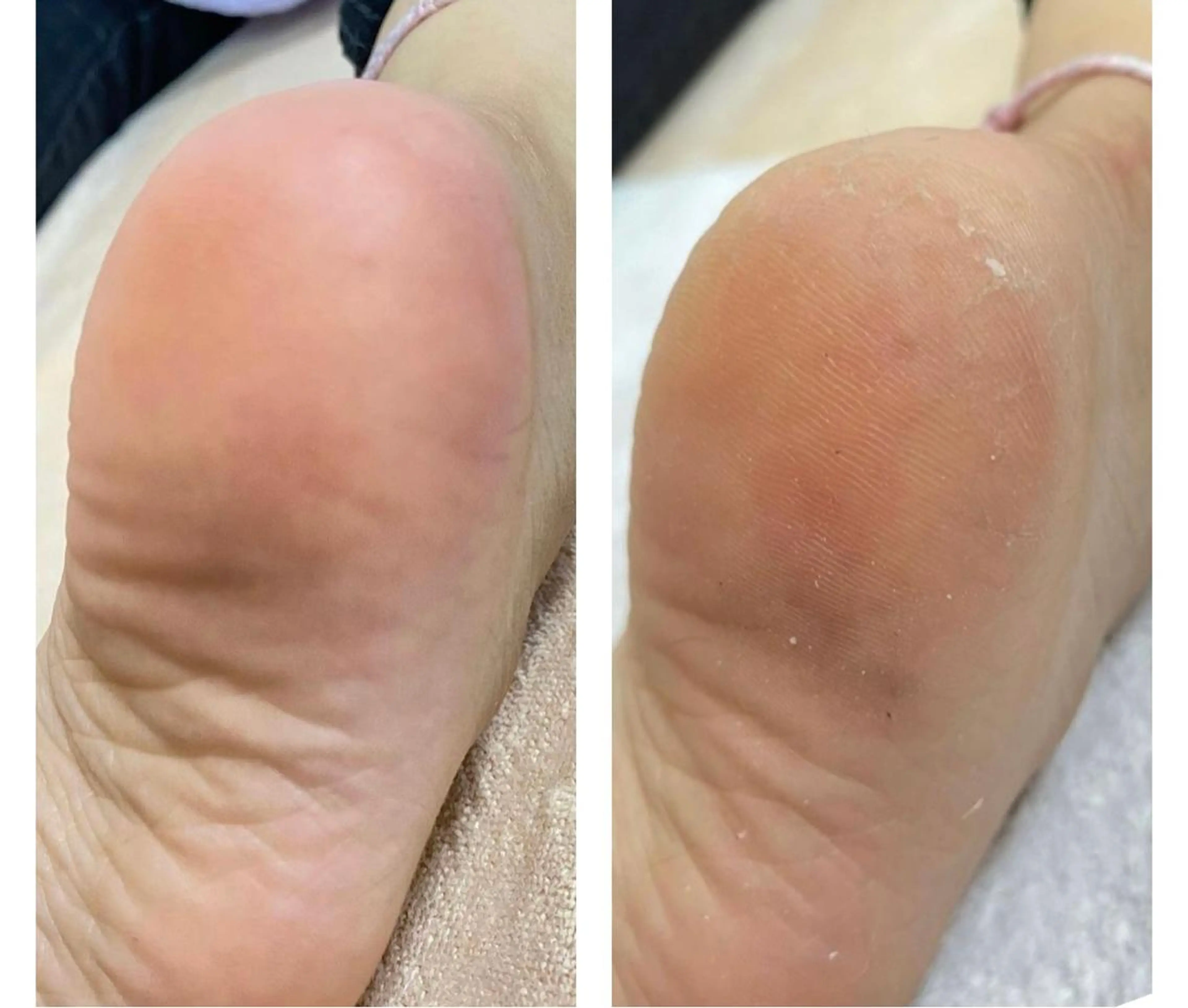 ネイル フットネイル Esthetic Will所属・will 有希のネイルデザイン