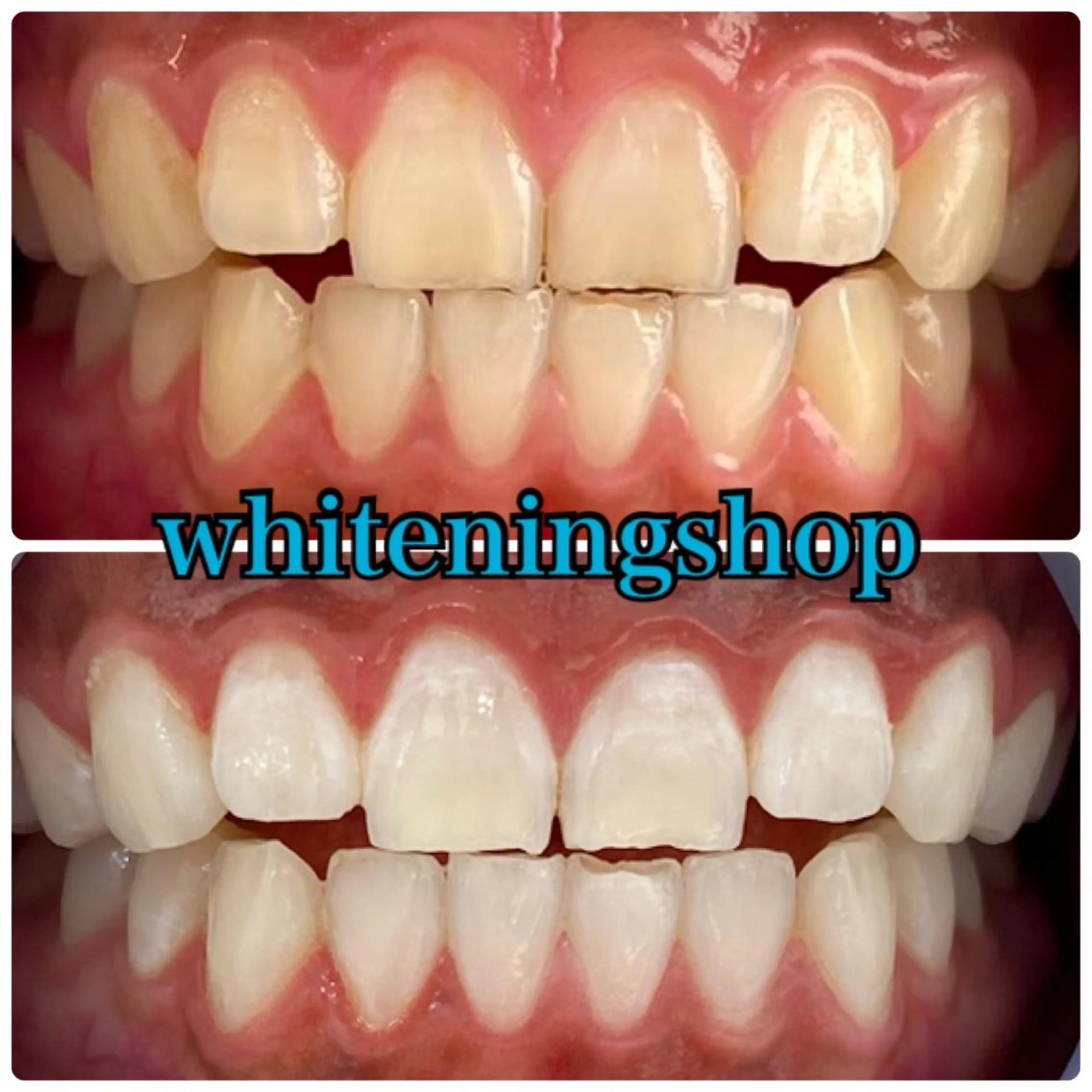 ホワイトニング ショップ吉祥寺店のエステ・リラクイメージ