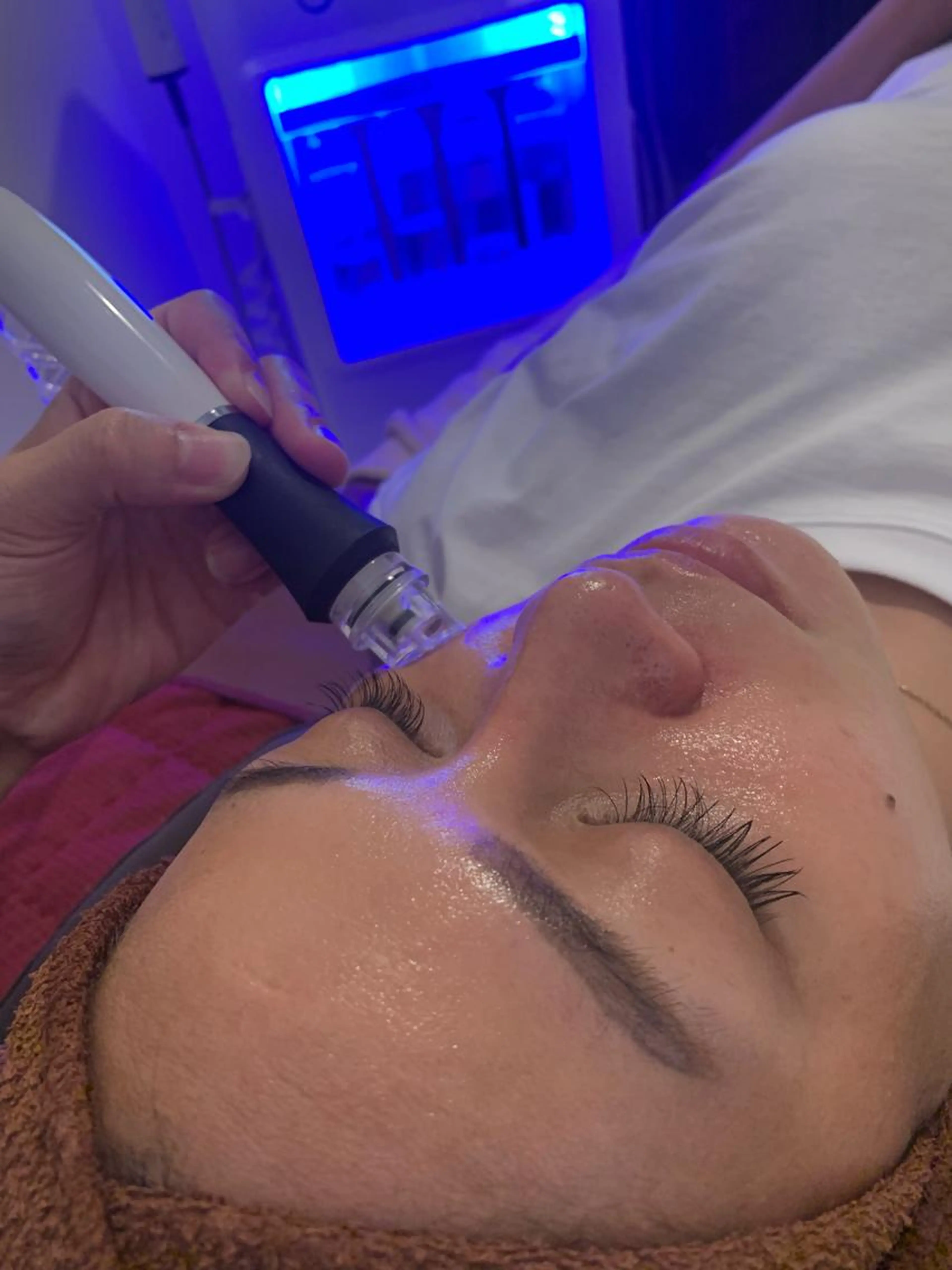 ☆ハイドロ毛穴洗浄☆つるんっと卵肌AQUAピーリングの写真