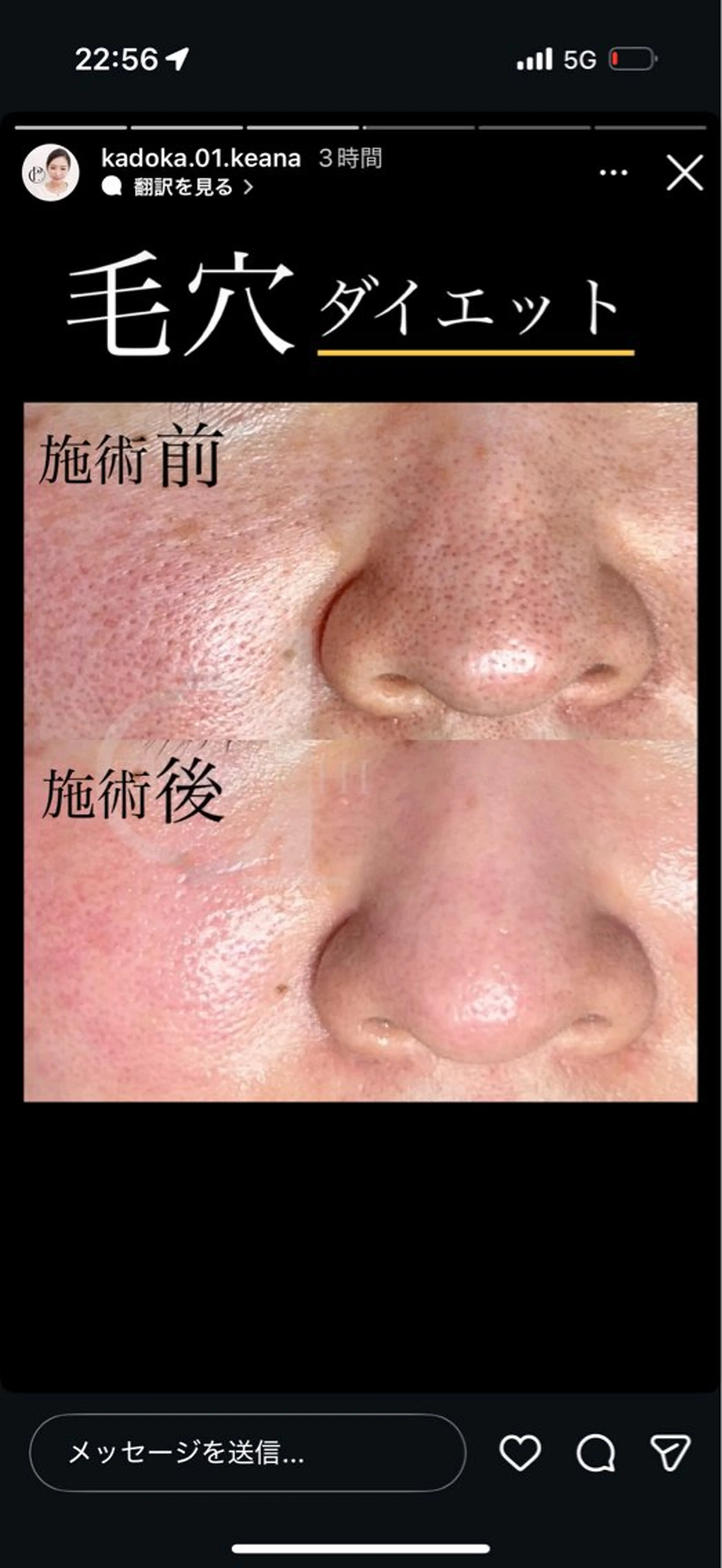 エステ akasha所属・渡部 ゆみのエステ・リラクイメージ