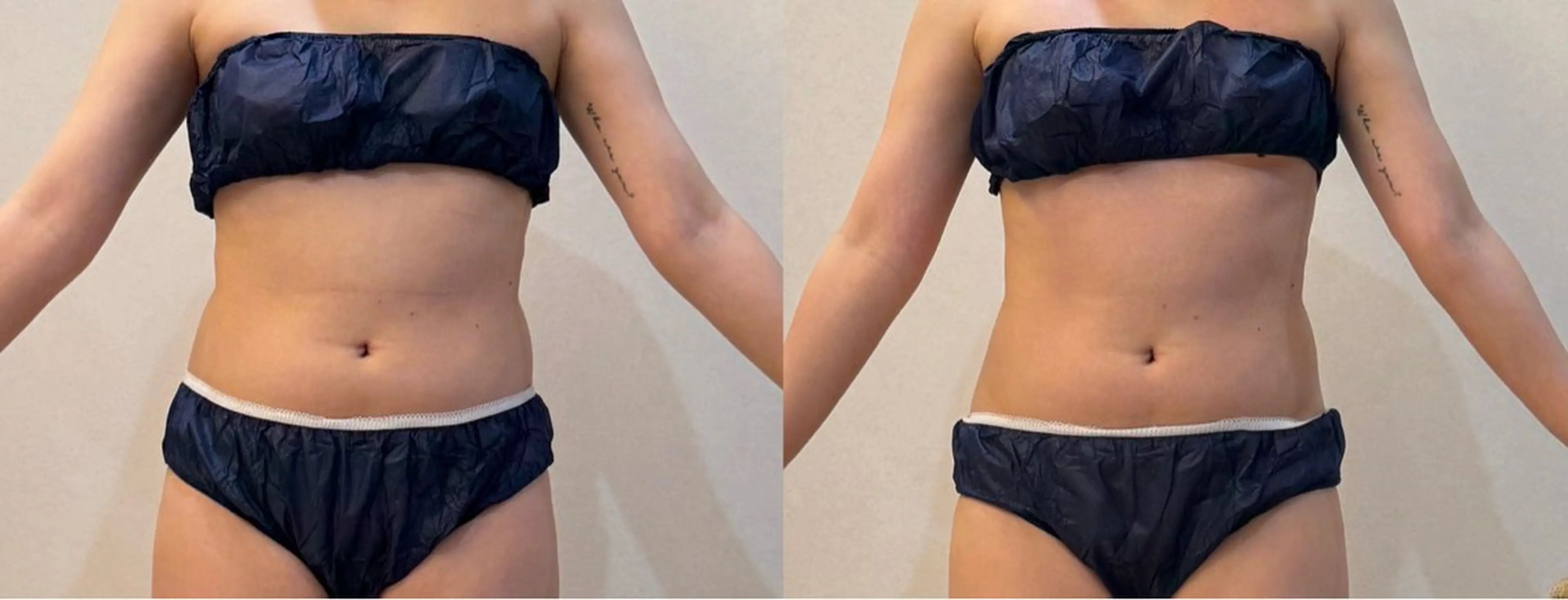 BeautySalon moze所属・moze 對島のエステ・リラクイメージ