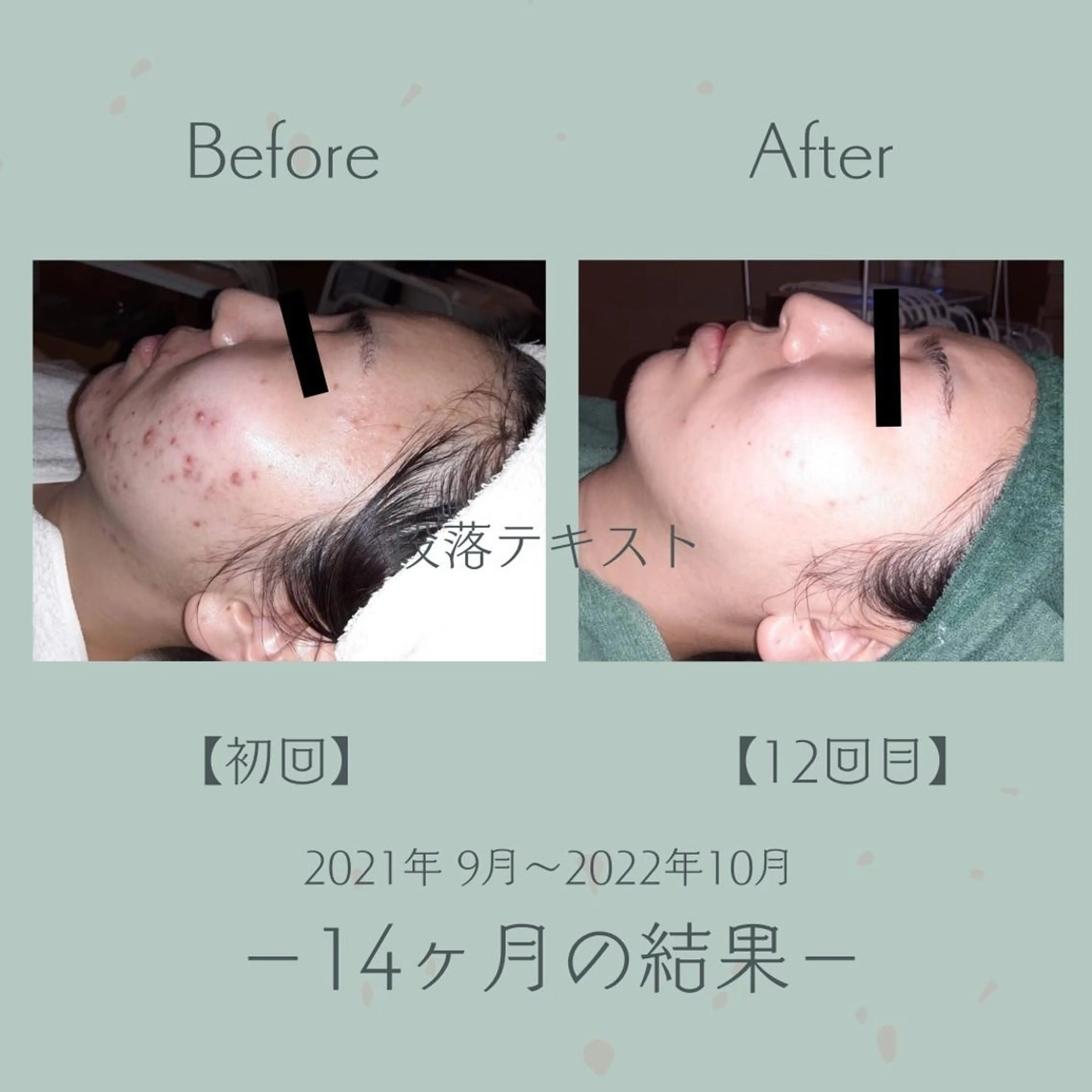 エステ＆美肌脱毛 ココサロ倉敷店のエステ・リラクイメージ