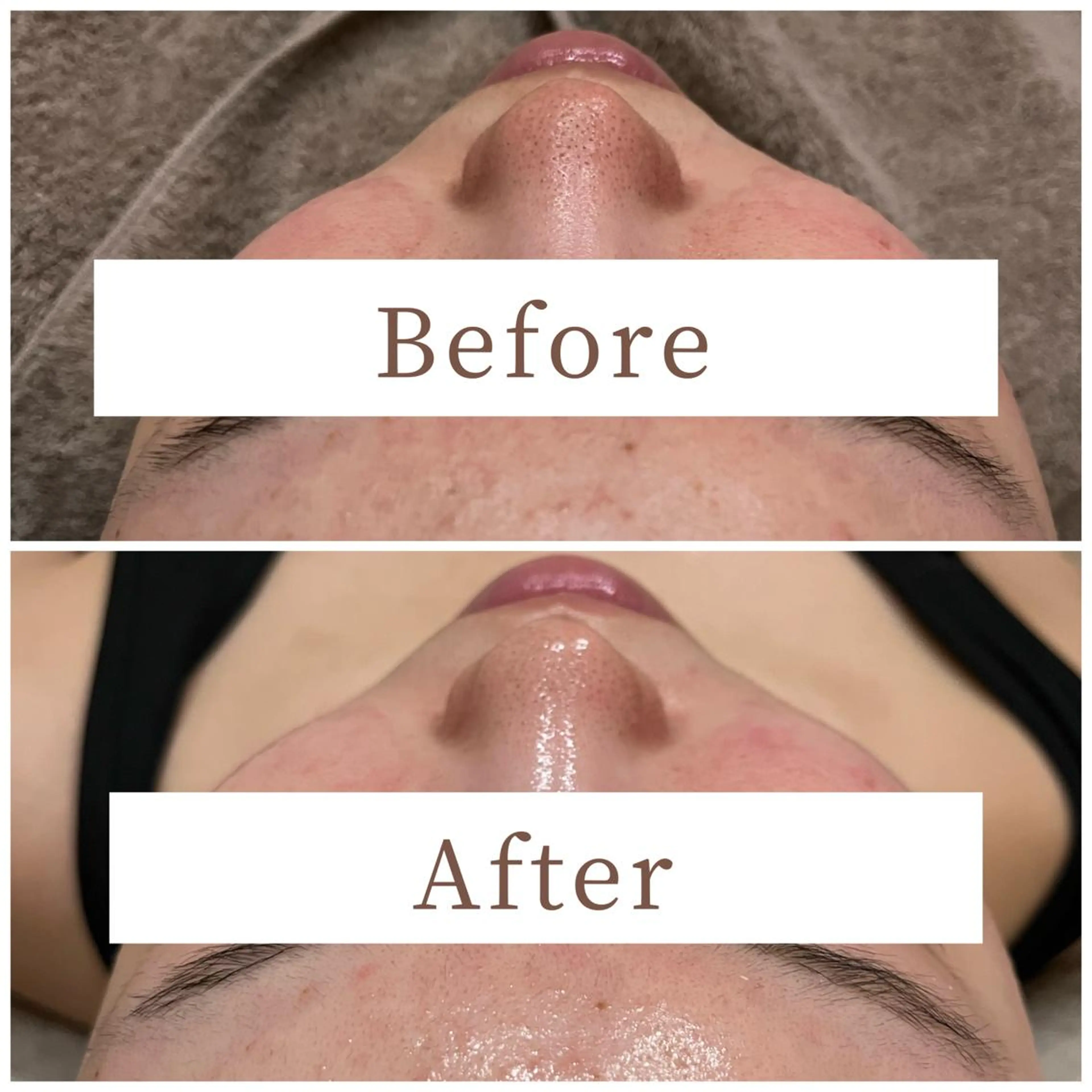 ハーブピーリング専門 muro.のエステ・リラクイメージ