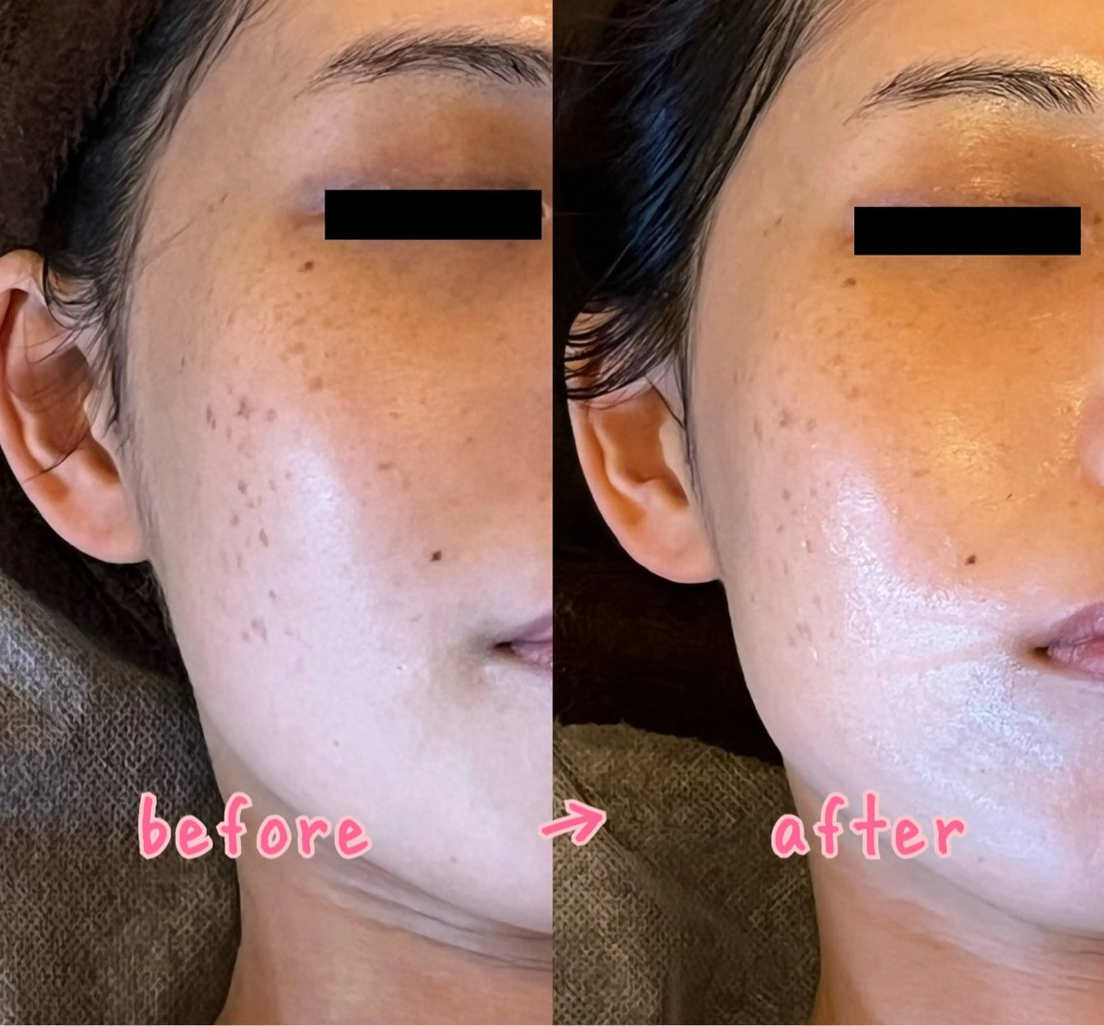 【ハーブピーリングリピーター専用】デコルテマッサージオプション30分※こちらのメニューのみでのご予約は承っておりません。の写真