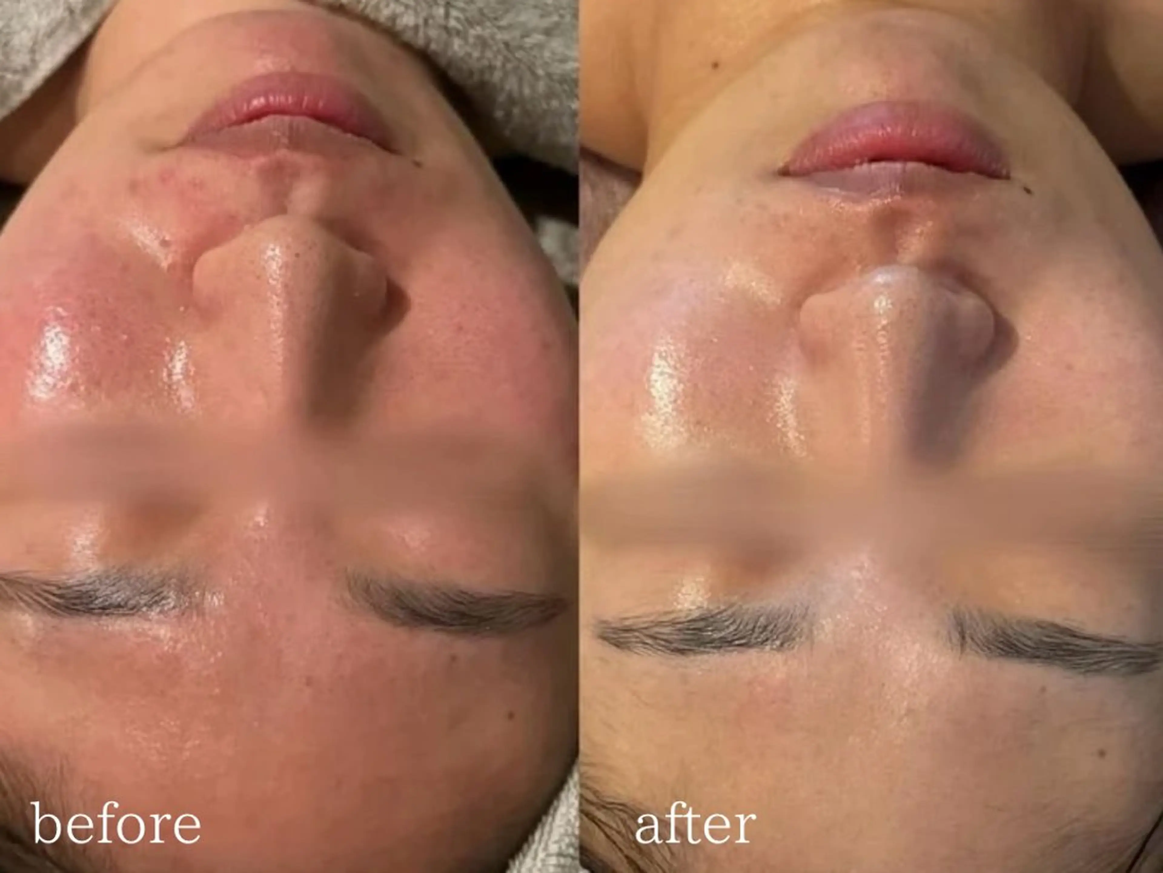 エステ 小顔×痩身専門サロンCLORE浦和店所属・石川 彩花のエステ・リラクイメージ