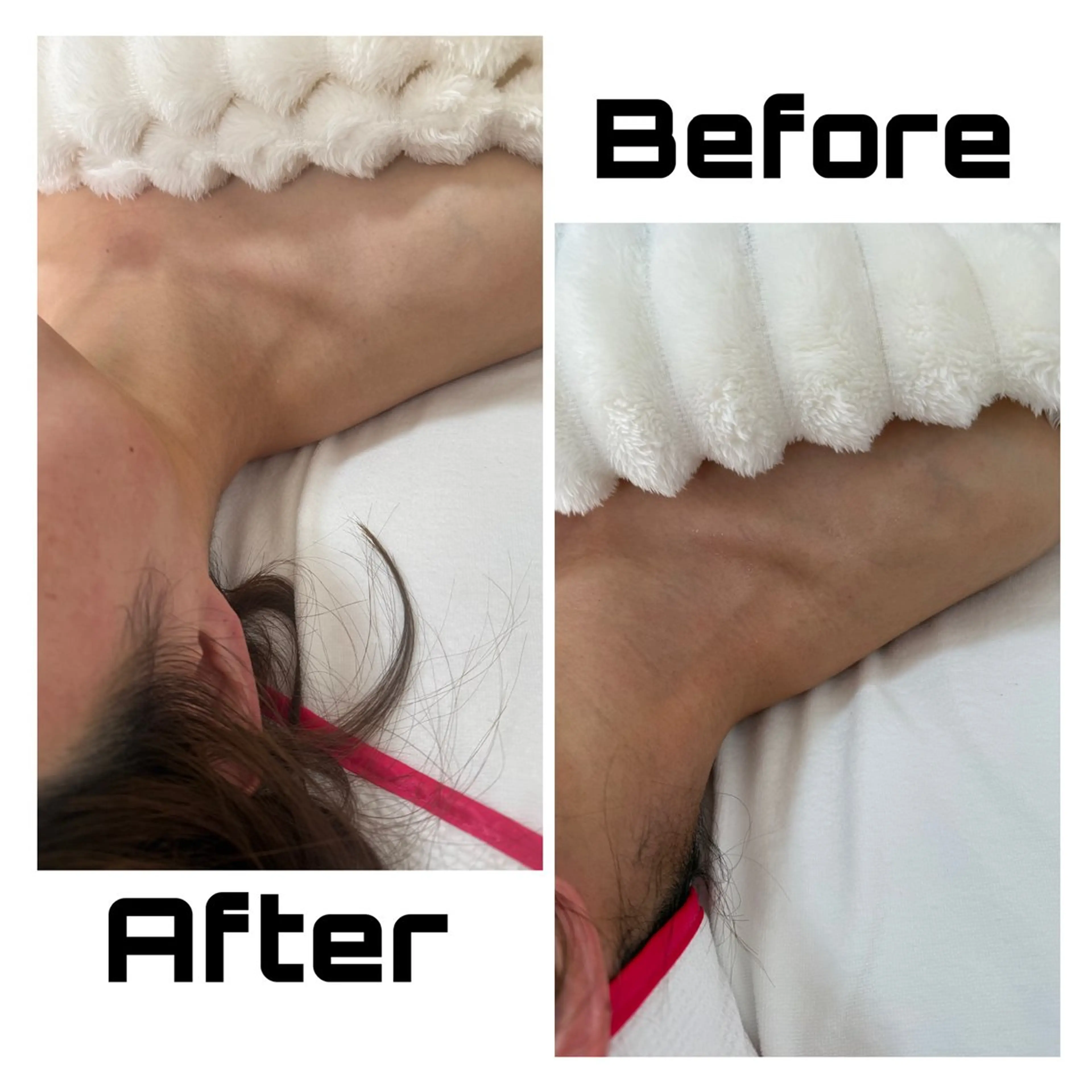 エステ リラク 【敏感肌管理×小顔サロン】Belle orchid所属・東三国/新大阪 敏感肌×小顔サロンのエステ・リラクイメージ