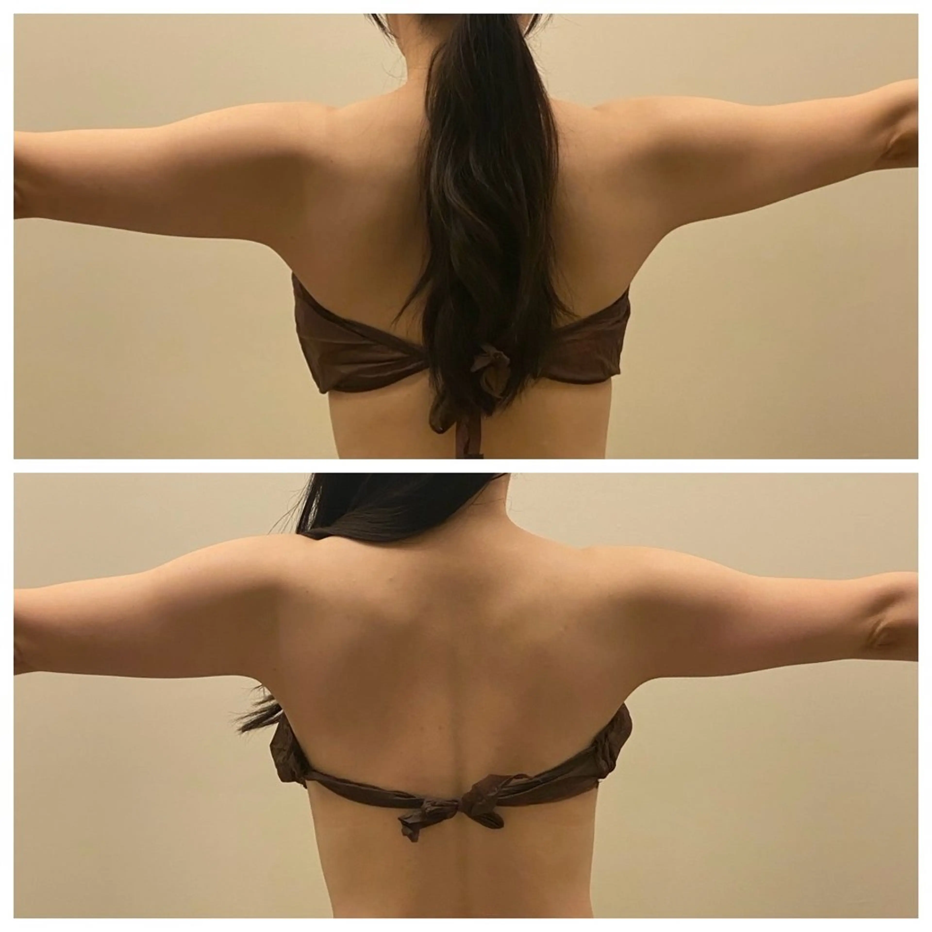 【初回】背中美人を目指して🩵スタイルアップの印象を💃背中&二の腕痩せ【最新痩身機器】の写真