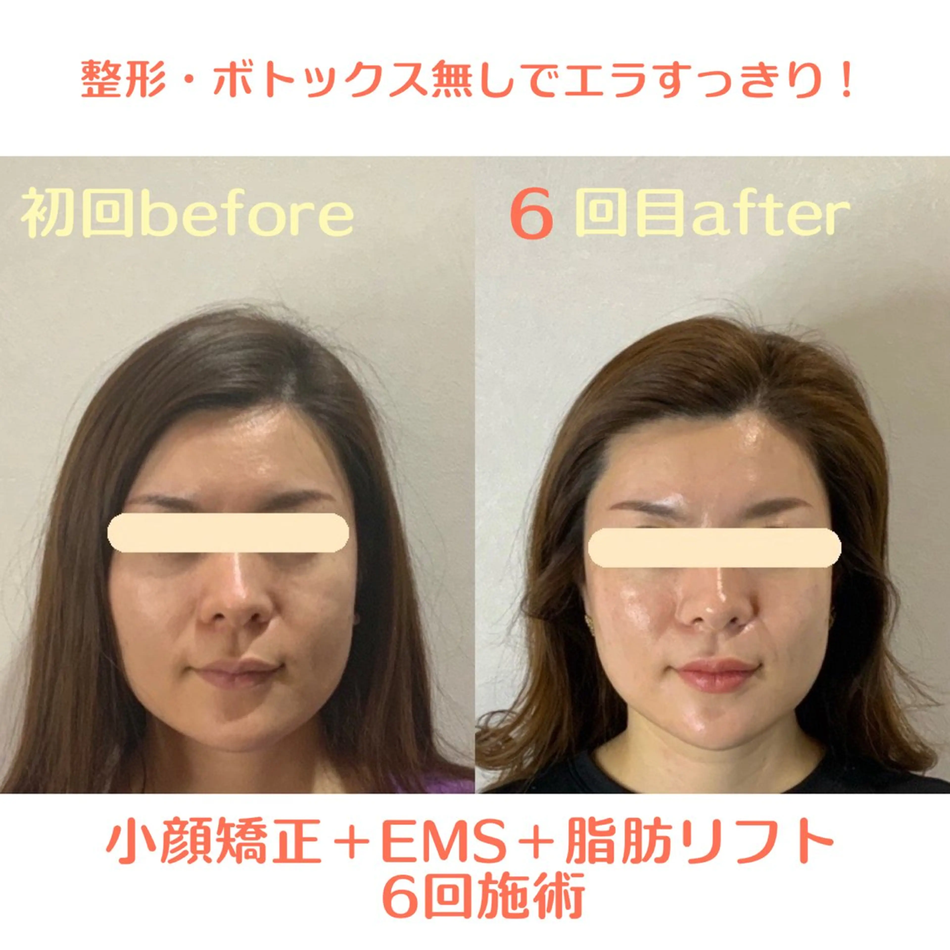 エステ 小顔・肌質改善 espoir 心斎橋のエステ・リラクイメージ