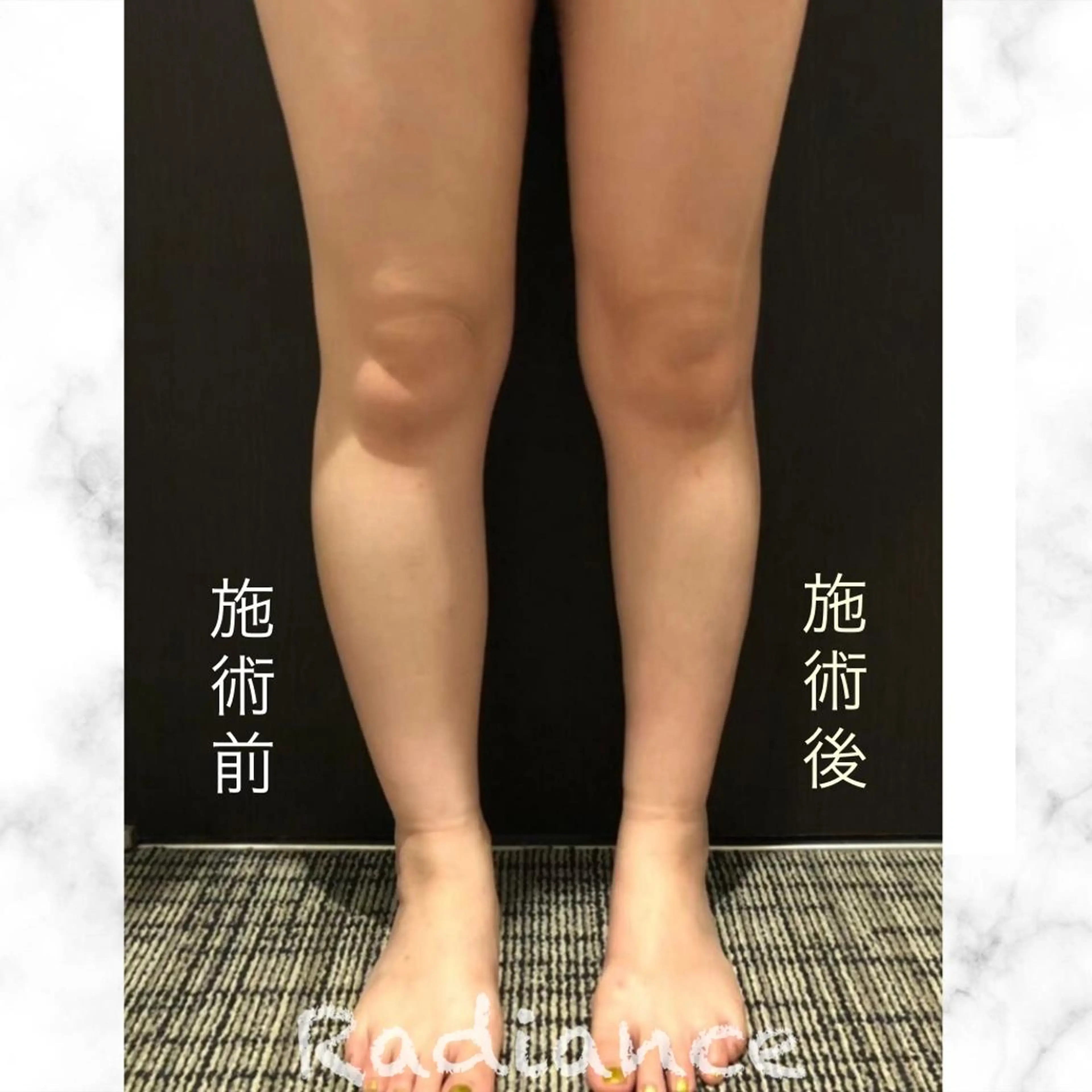 札幌ホワイトニング ラディアンス菊水店のその他イメージ