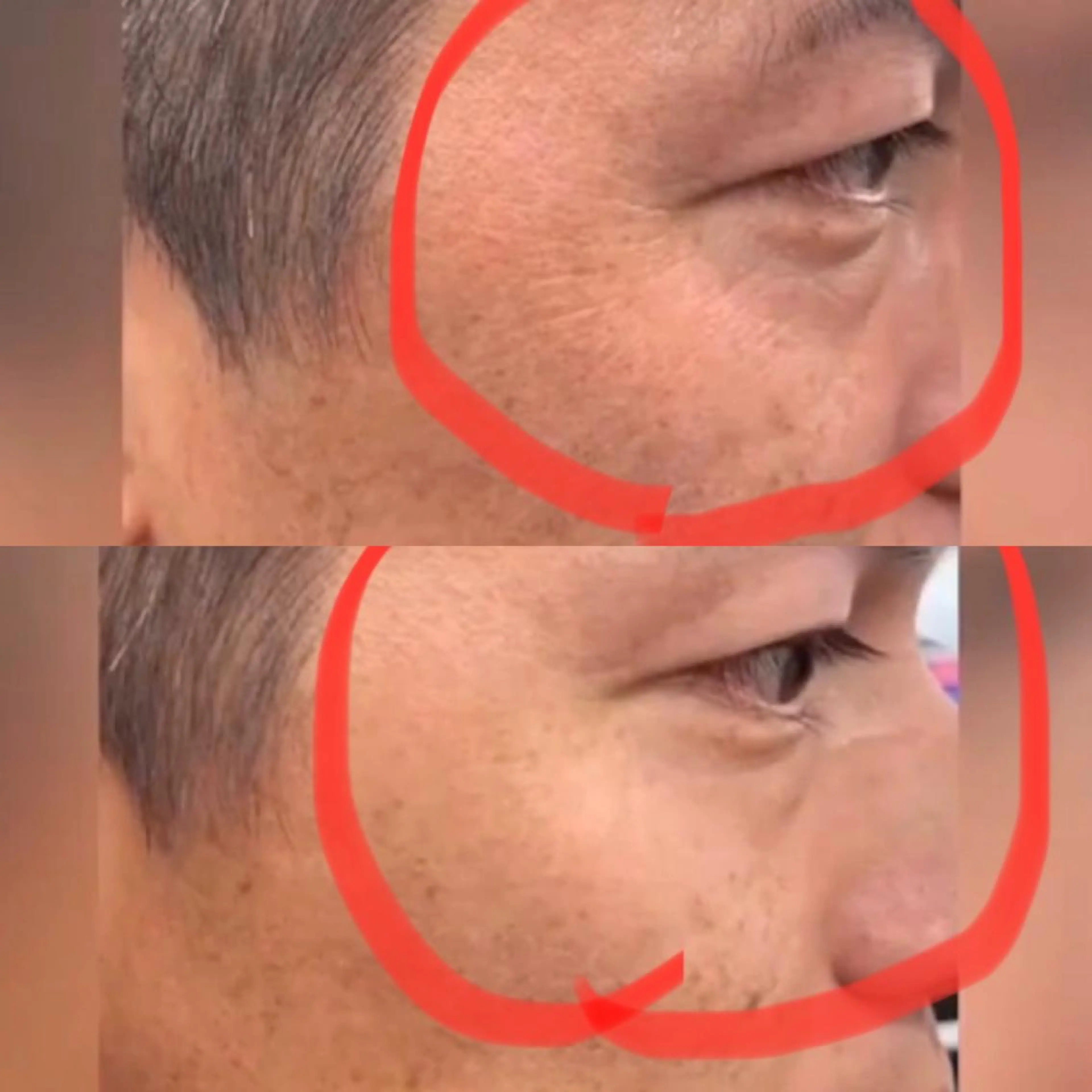 Meetite 小林のエステ・リラクイメージ