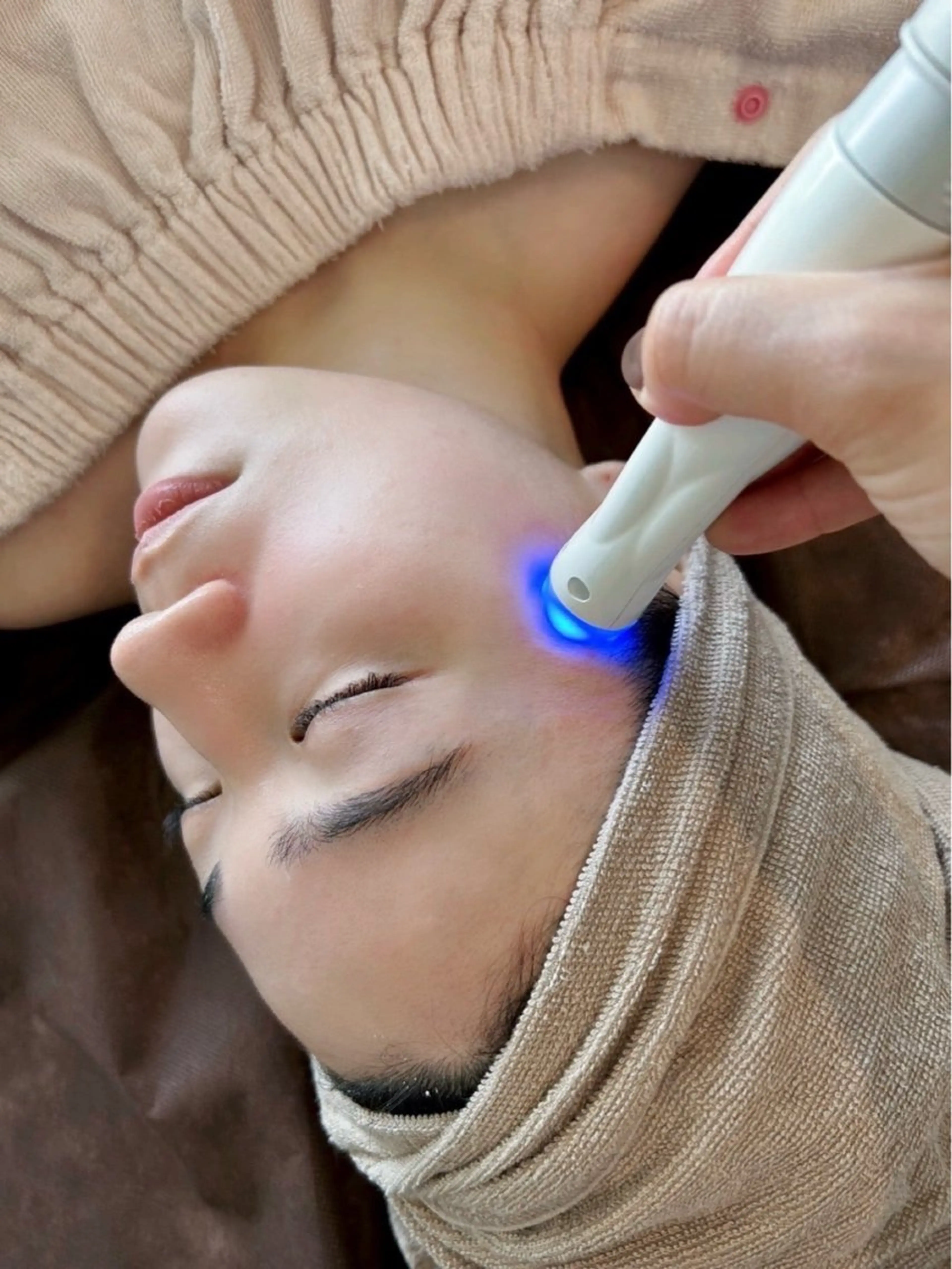 【小顔・リフトアップ】ラジオ波とLEDと吸引でフェイスラインスッキリ！お肌のトーンも上がります。ヘッドマッサージ付きの写真